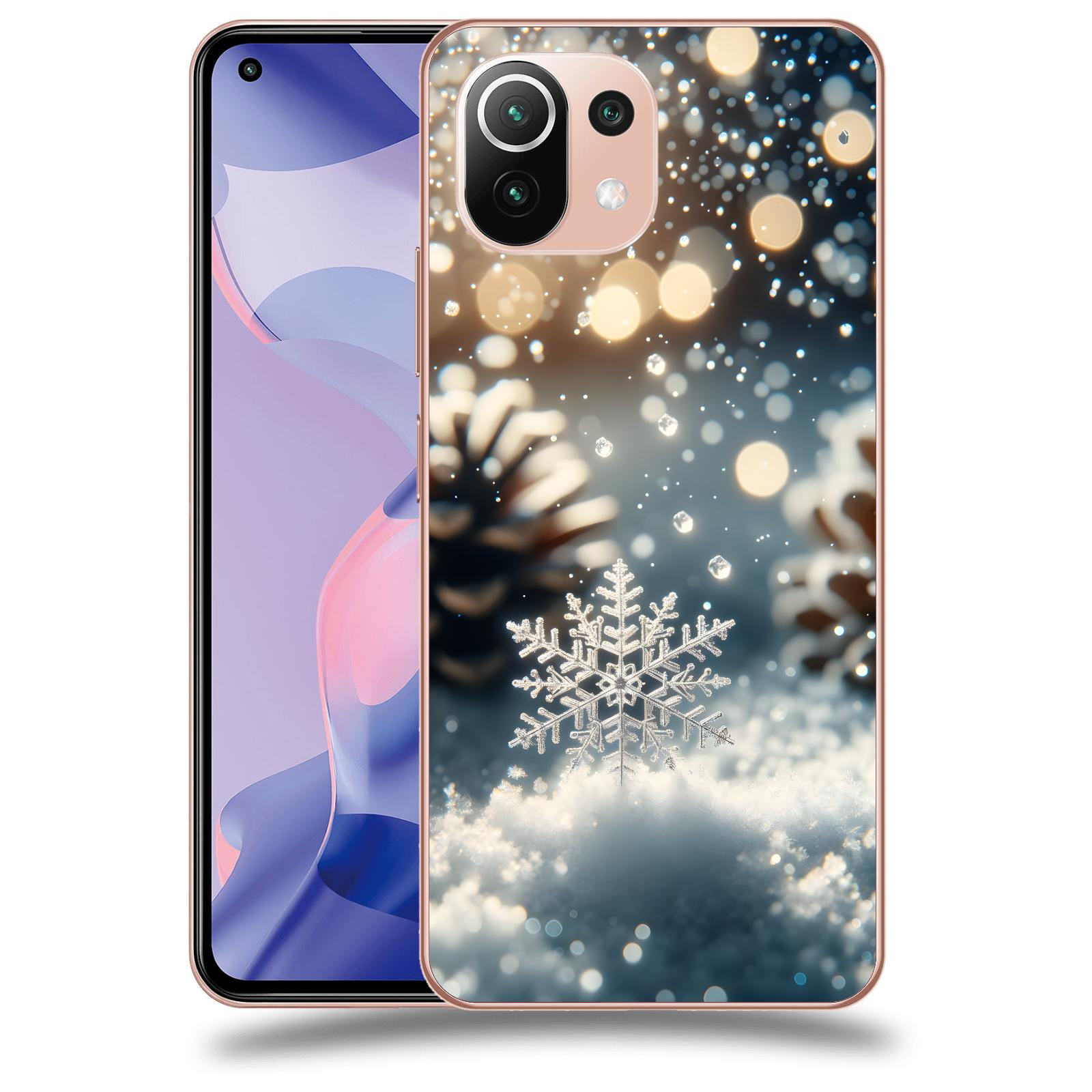 ACOVER Kryt na mobil Xiaomi 11 Lite 5G NE - Vločka