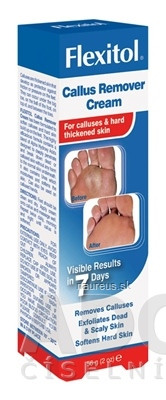 Thornton and Ross Limited FLEXITOL Callus NA otlaků a zhrubnutí KŮŽI 1x56 g 56g