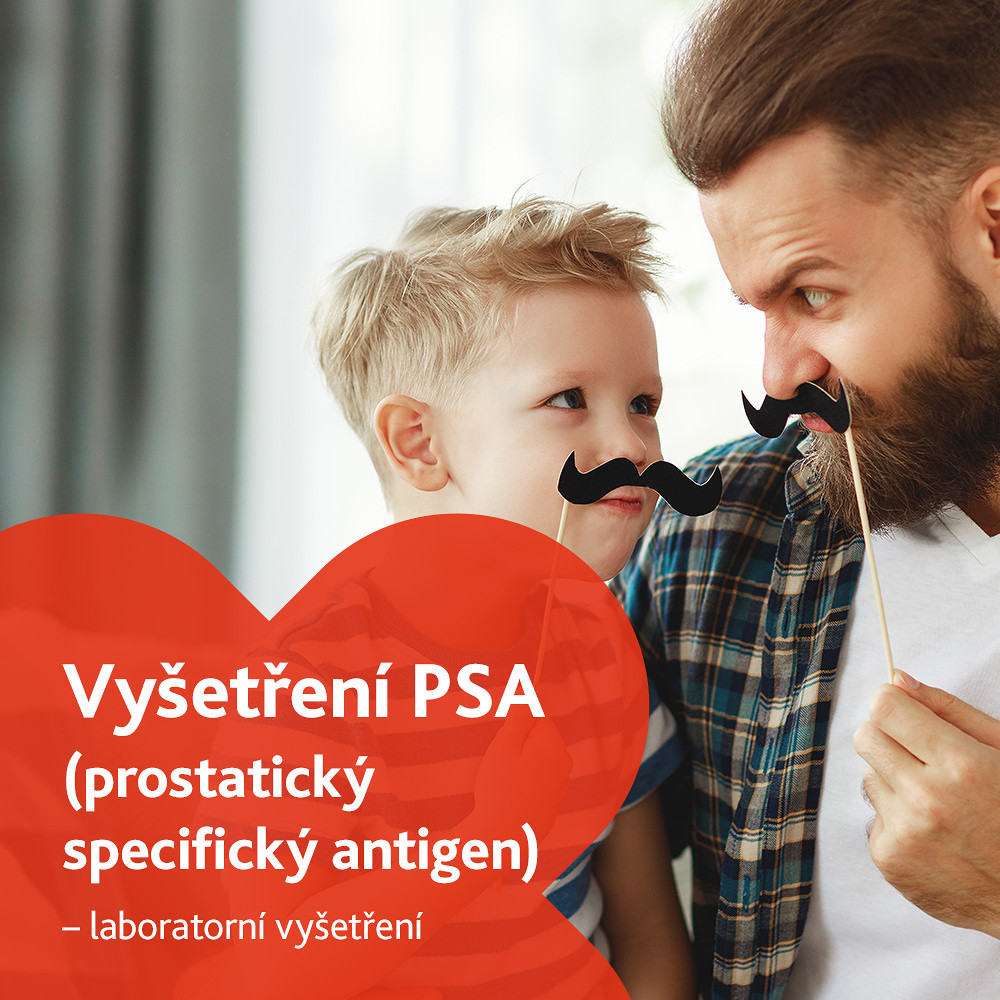 Vyšetření PSA (Prostatický specifický antigen) - laboratorní vyšetření