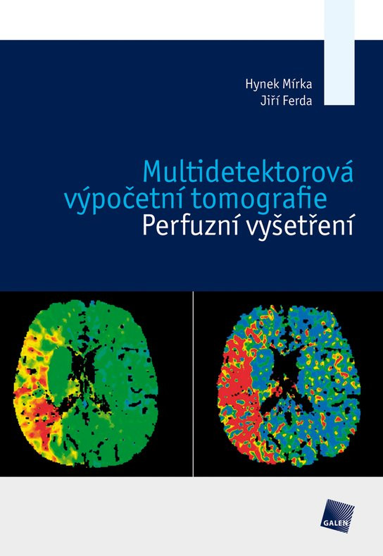 Multidetektorová výpočetní tomografie