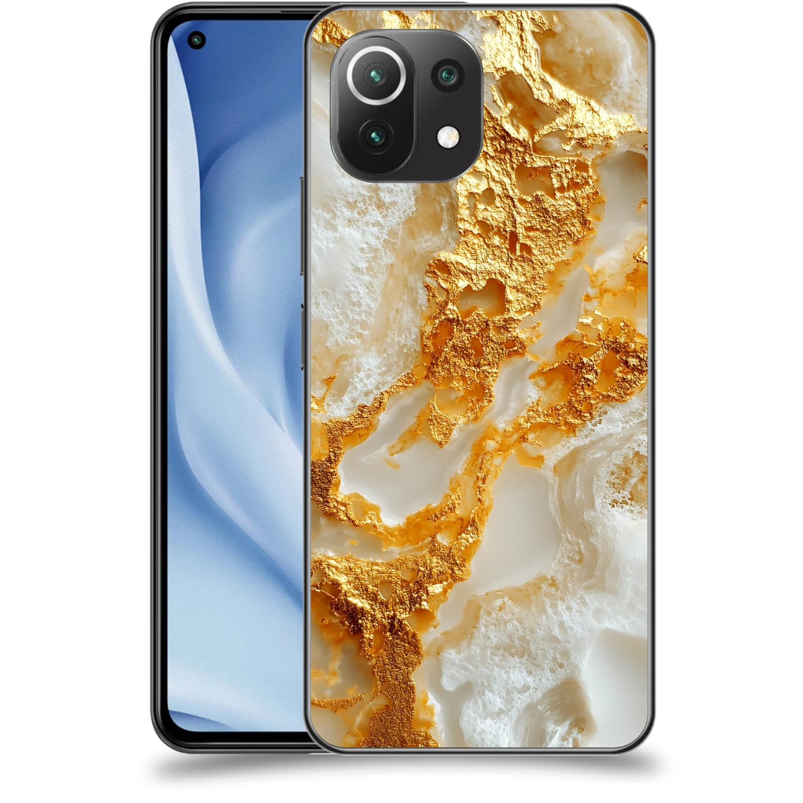 ACOVER Kryt na mobil Xiaomi Mi 11 Lite - Vanilla Bourbon II