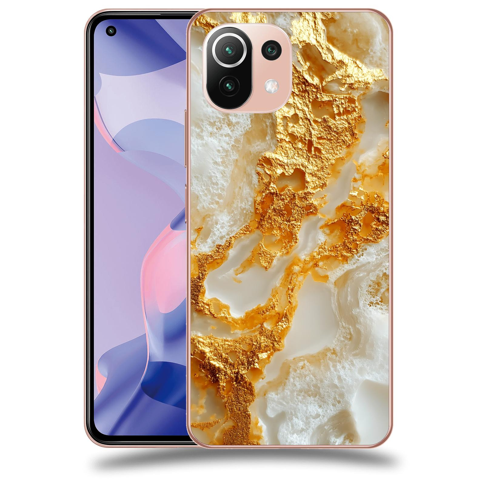 ACOVER Kryt na mobil Xiaomi 11 Lite 5G NE - Vanilla Bourbon II