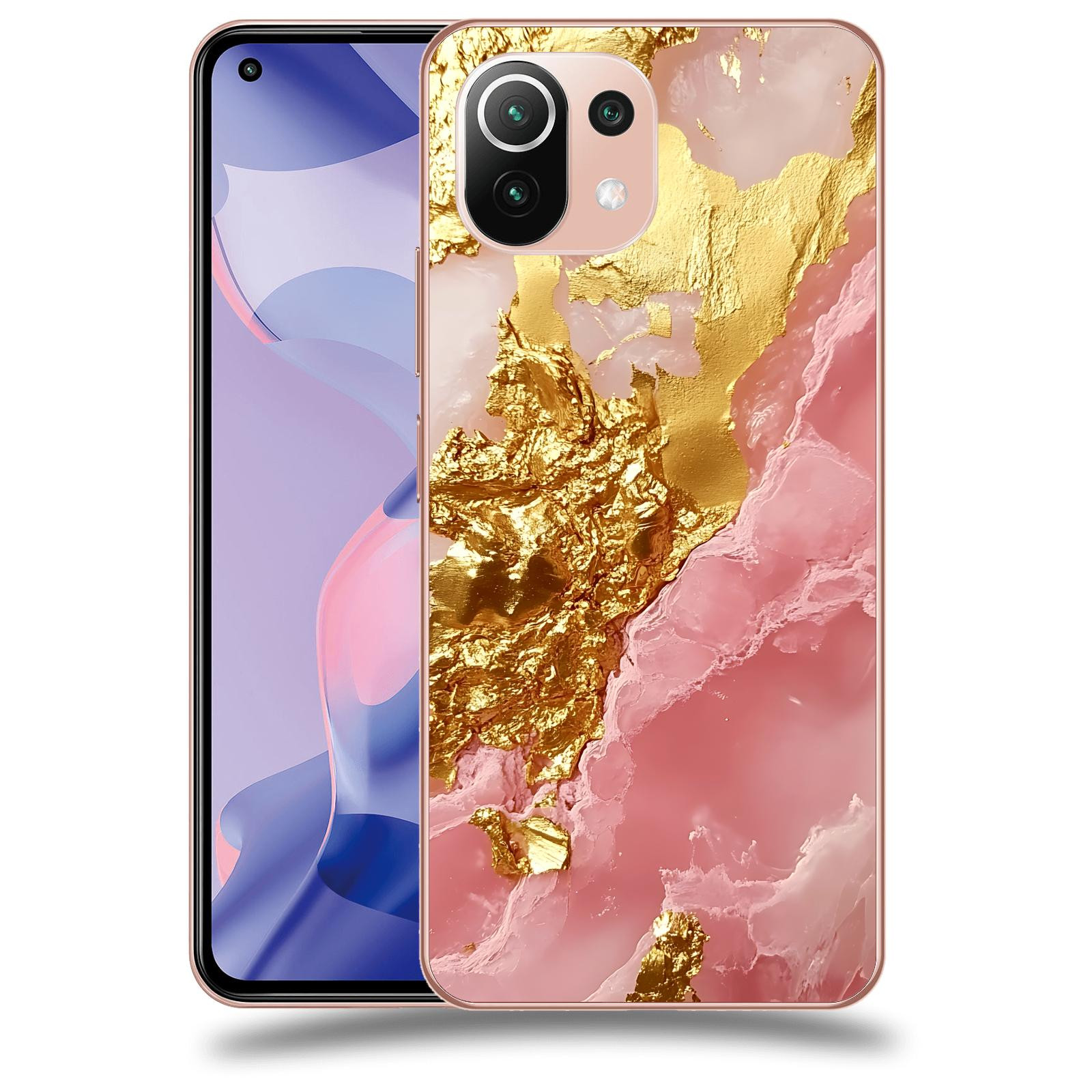ACOVER Kryt na mobil Xiaomi 11 Lite 5G NE - Sweet Dream II