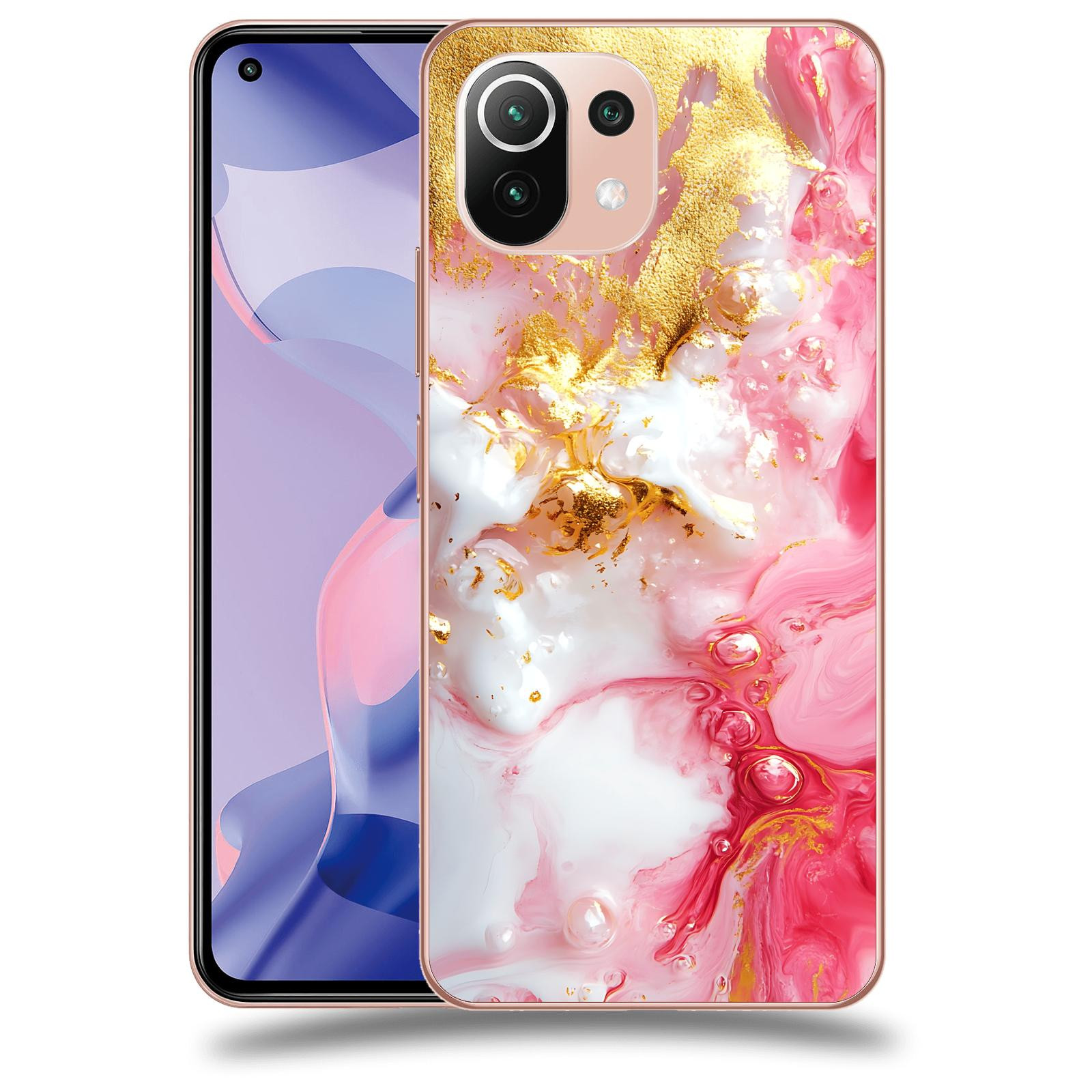 ACOVER Kryt na mobil Xiaomi 11 Lite 5G NE - Sweet Dream I