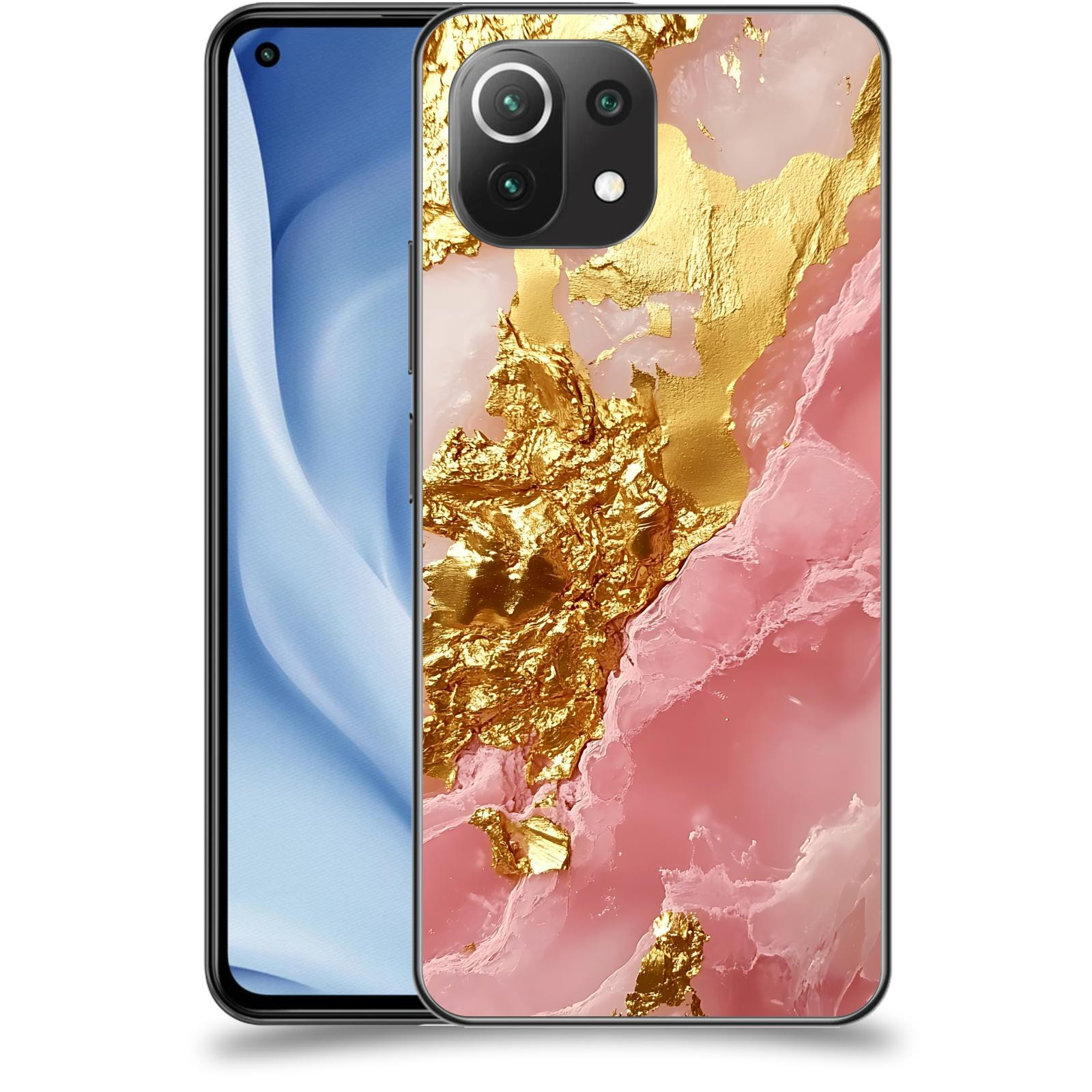 ACOVER Kryt na mobil Xiaomi Mi 11 Lite - Sweet Dream II