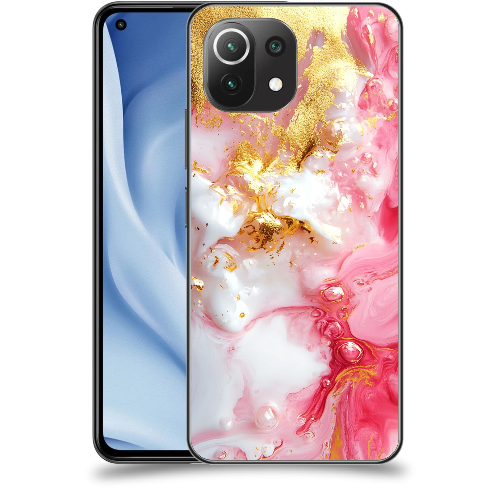 ACOVER Kryt na mobil Xiaomi Mi 11 Lite - Sweet Dream I