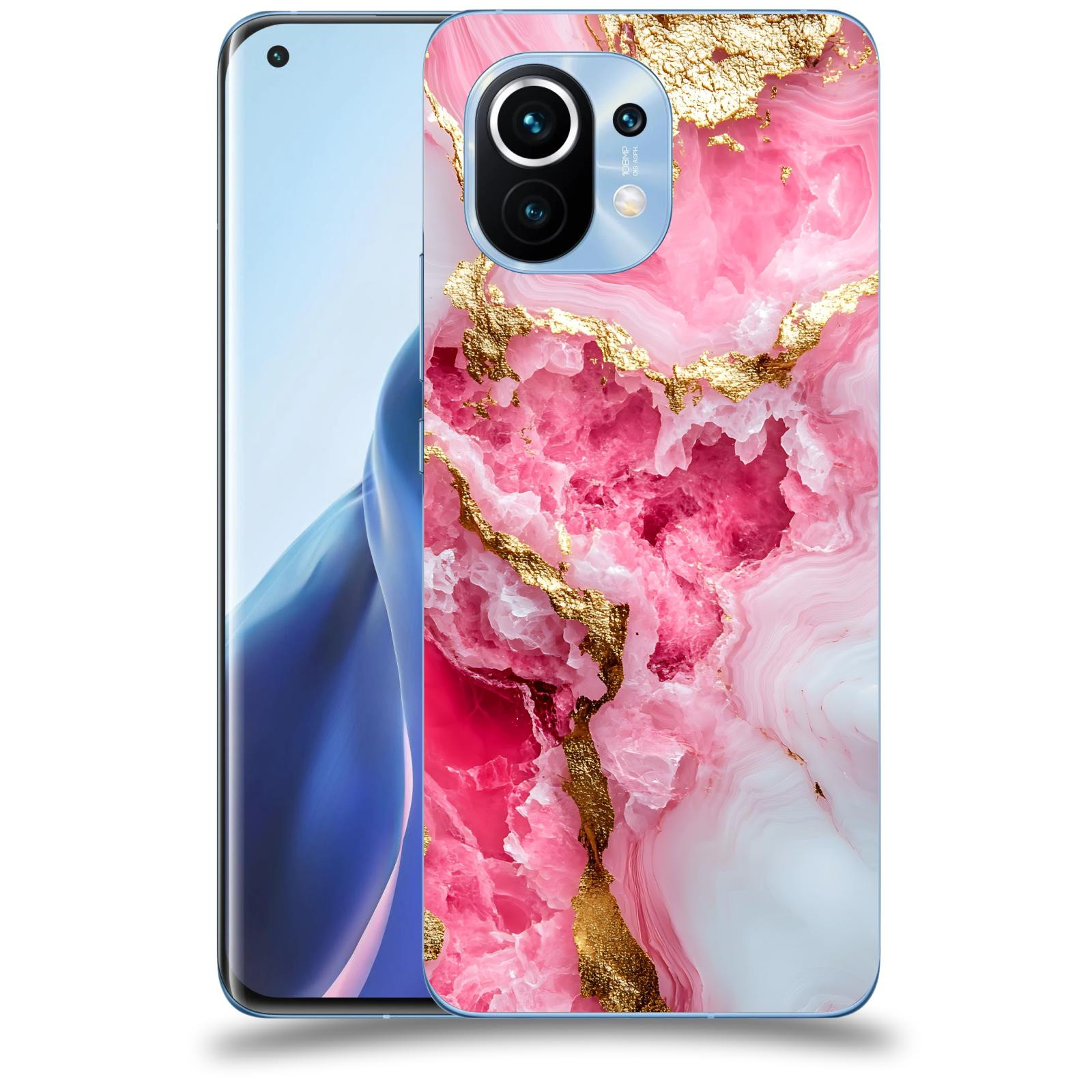 ACOVER Kryt na mobil Xiaomi Mi 11 - Sweet Dream III