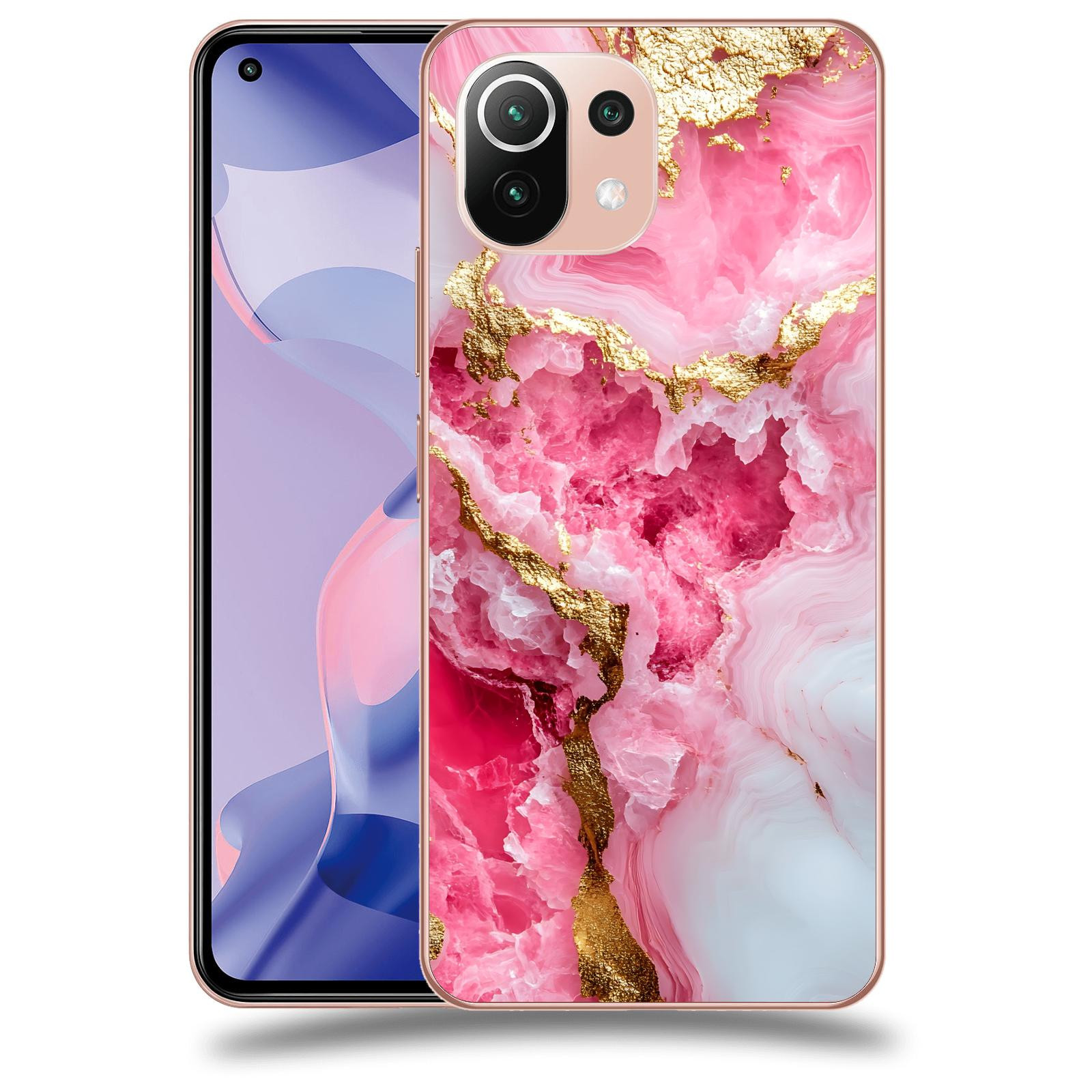 ACOVER Kryt na mobil Xiaomi 11 Lite 5G NE - Sweet Dream III