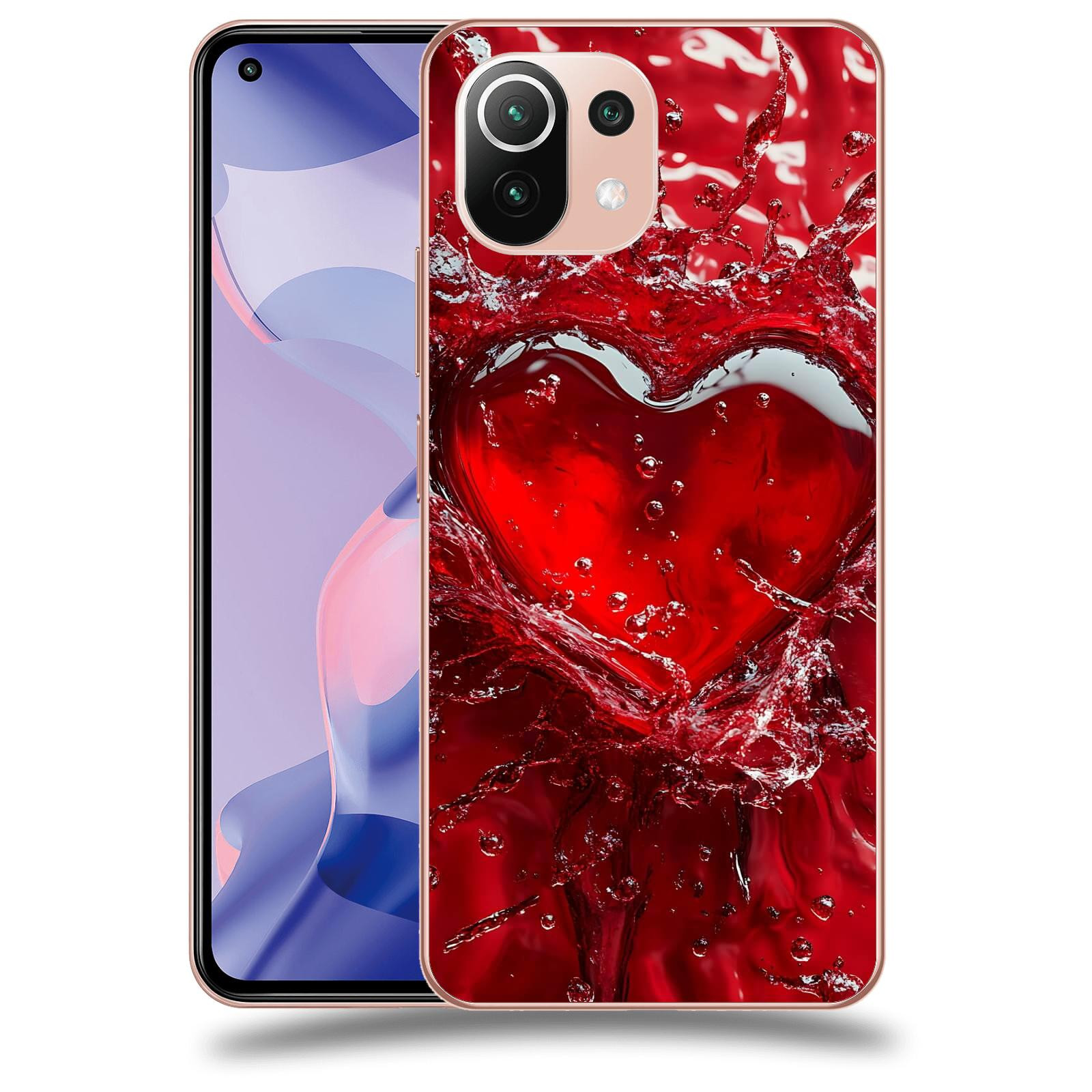 ACOVER Kryt na mobil Xiaomi 11 Lite 5G NE - Love I