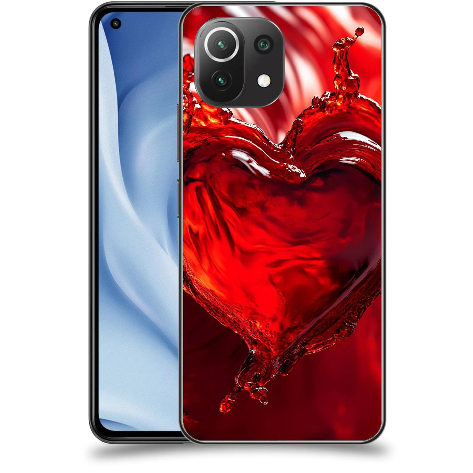 ACOVER Kryt na mobil Xiaomi Mi 11 Lite - Love II