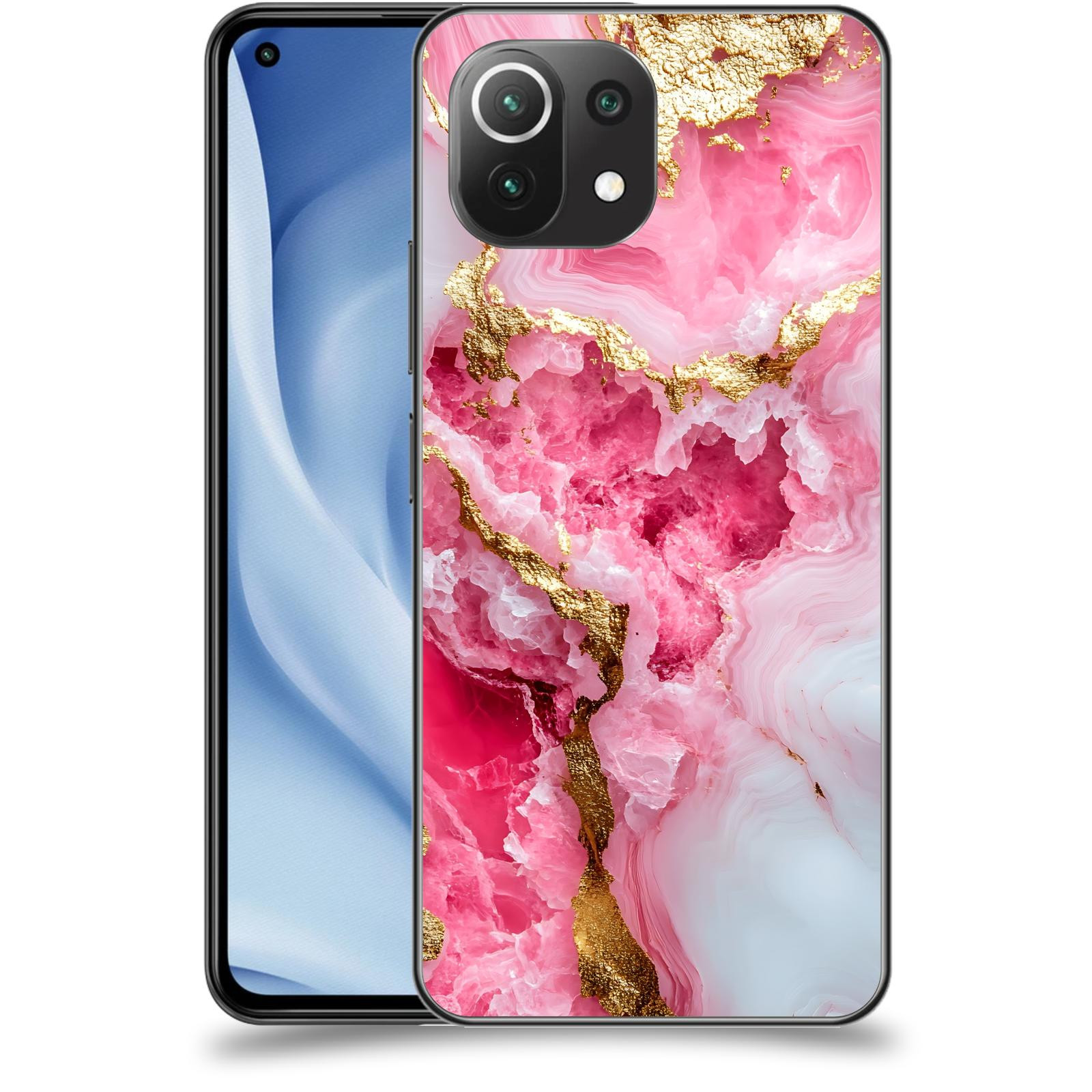 ACOVER Kryt na mobil Xiaomi Mi 11 Lite - Sweet Dream III