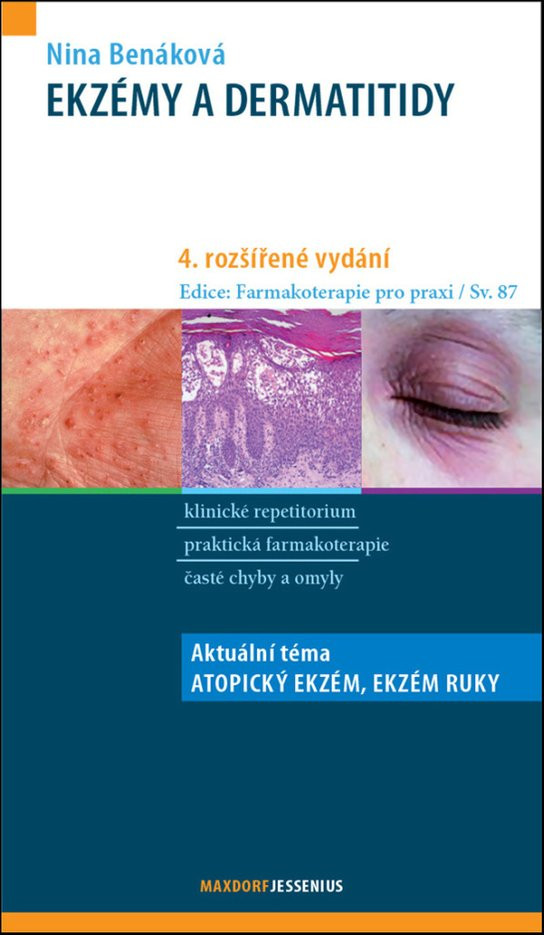 Ekzémy a dermatitidy