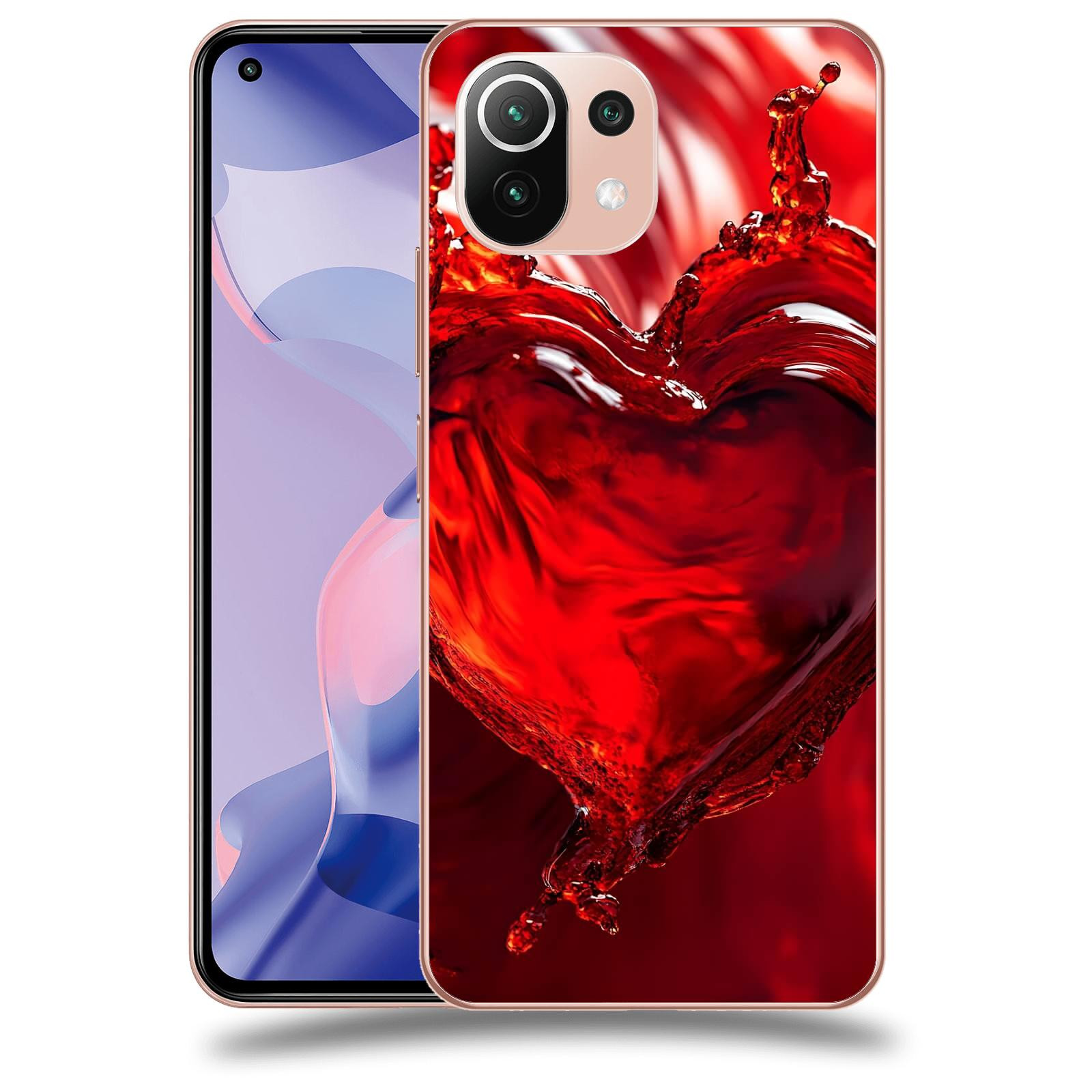 ACOVER Kryt na mobil Xiaomi 11 Lite 5G NE - Love II