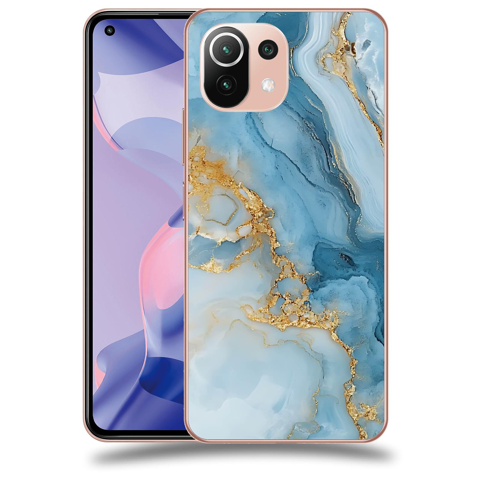 ACOVER Kryt na mobil Xiaomi 11 Lite 5G NE - Ice Marble II