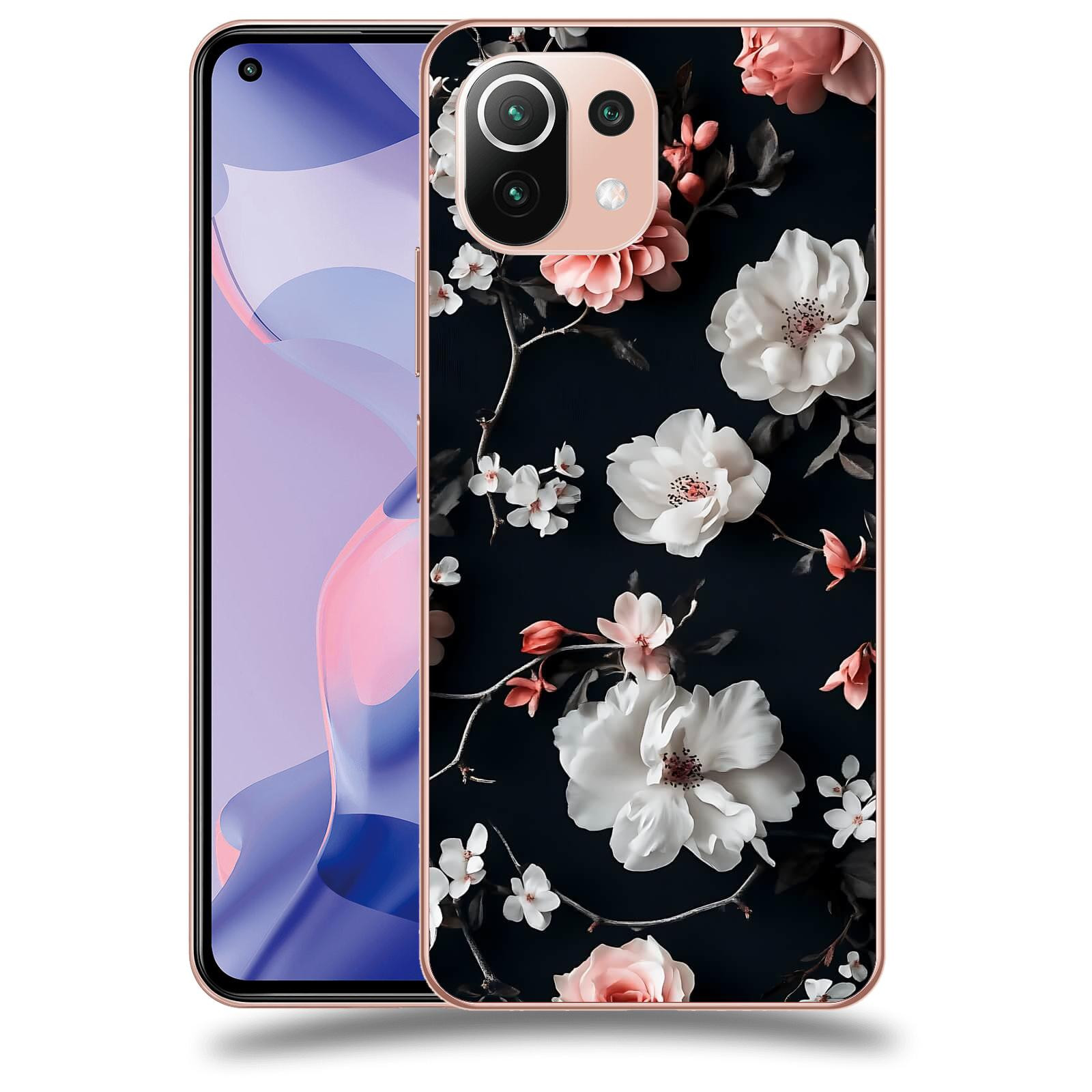 ACOVER Kryt na mobil Xiaomi 11 Lite 5G NE - Elegantní kontrast