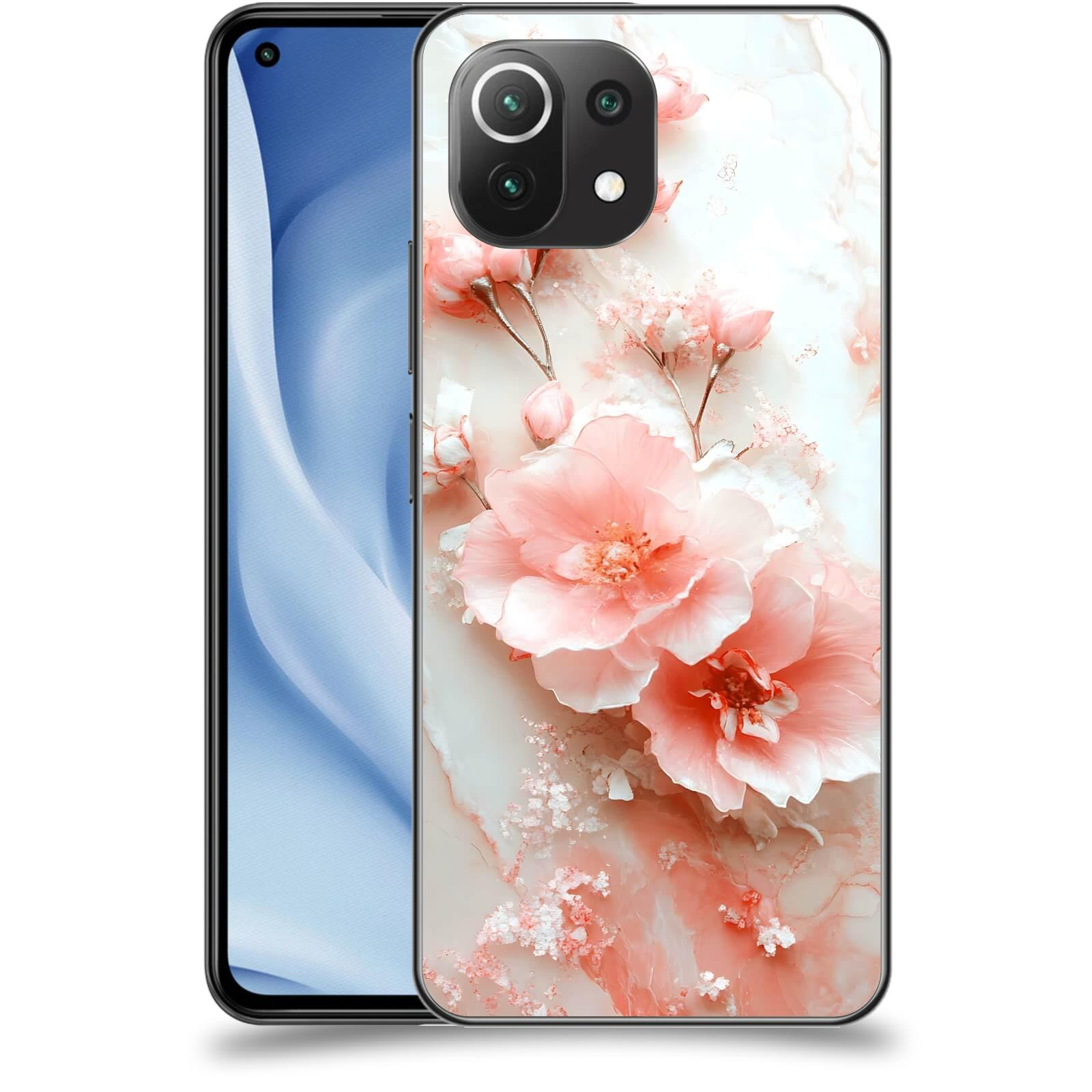 ACOVER Kryt na mobil Xiaomi Mi 11 Lite - Jemná elegance
