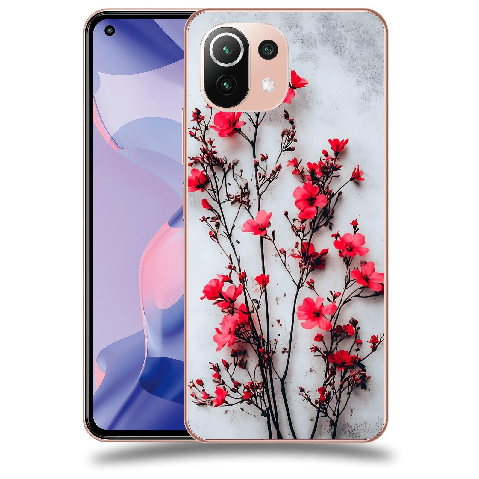 ACOVER Kryt na mobil Xiaomi 11 Lite 5G NE - Kontrastní elegance