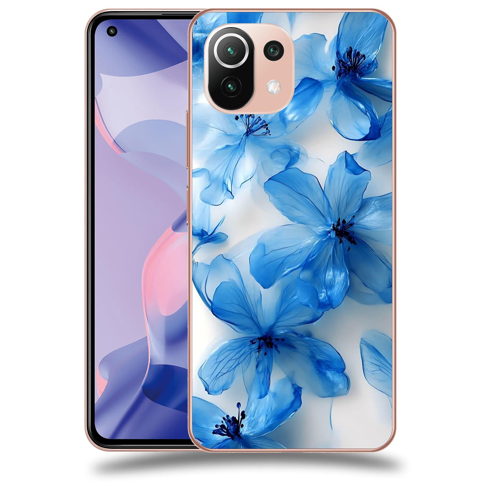 ACOVER Kryt na mobil Xiaomi 11 Lite 5G NE - Křišťálová jemnost