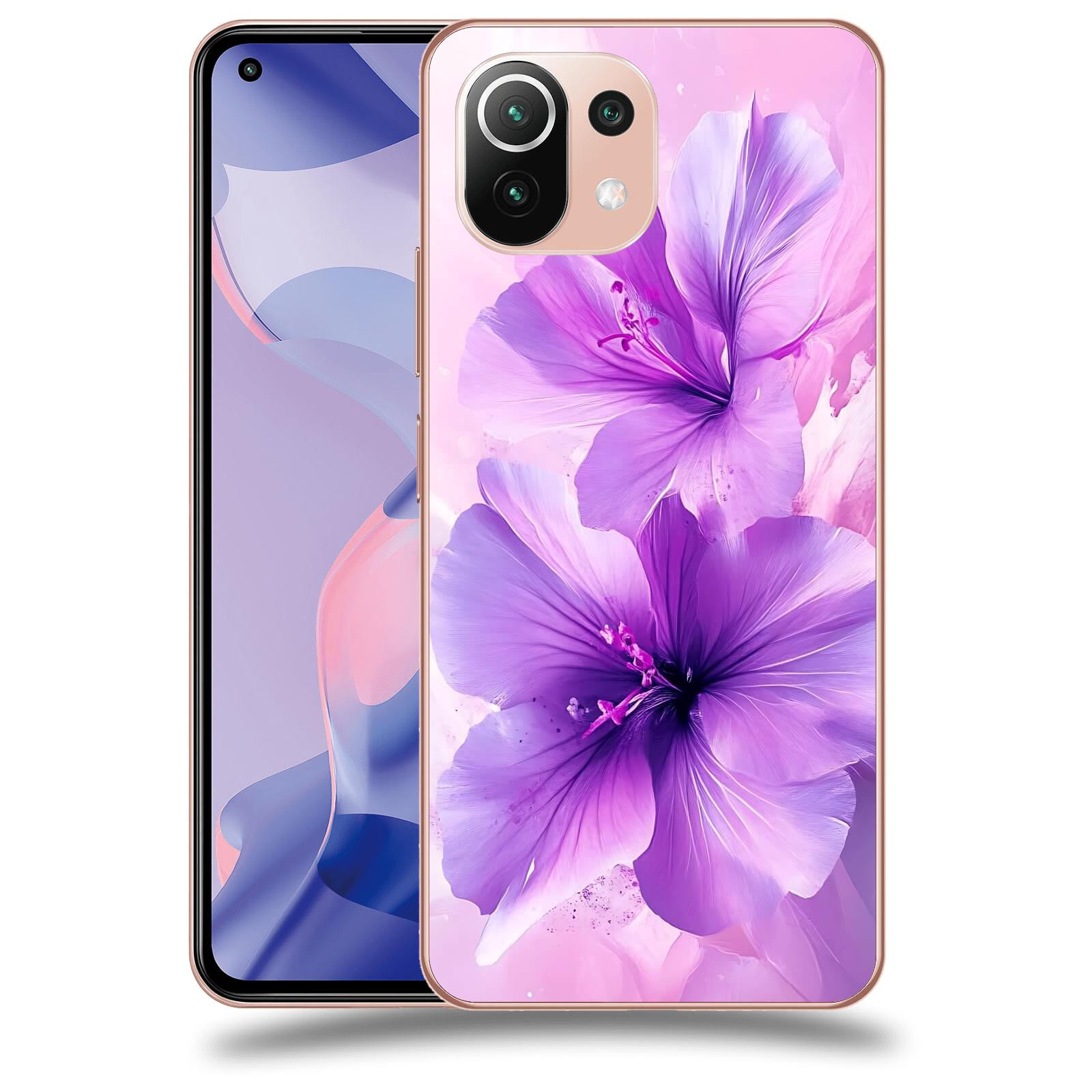 ACOVER Kryt na mobil Xiaomi 11 Lite 5G NE - Něžná elegance