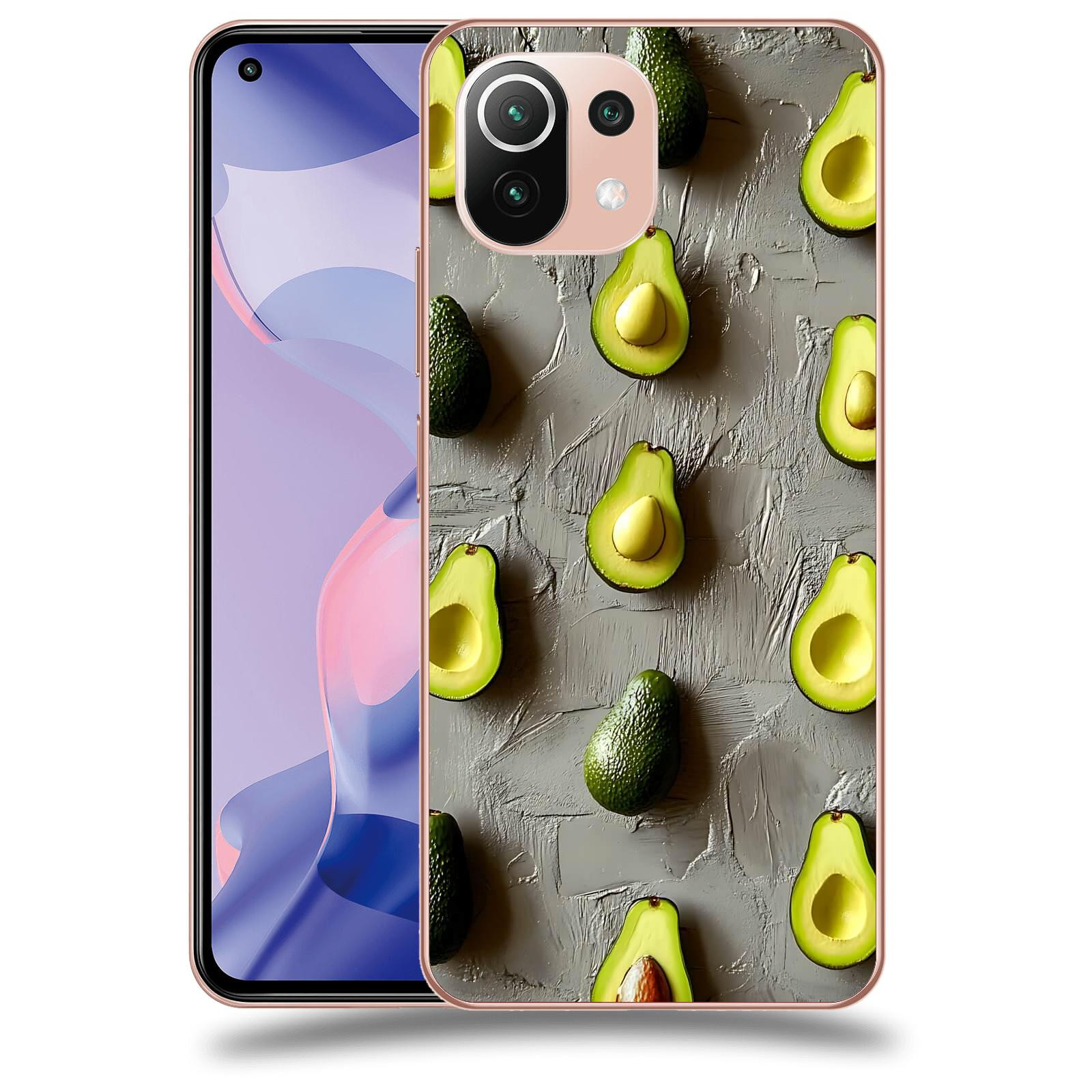 ACOVER Kryt na mobil Xiaomi 11 Lite 5G NE - Zelená harmonie
