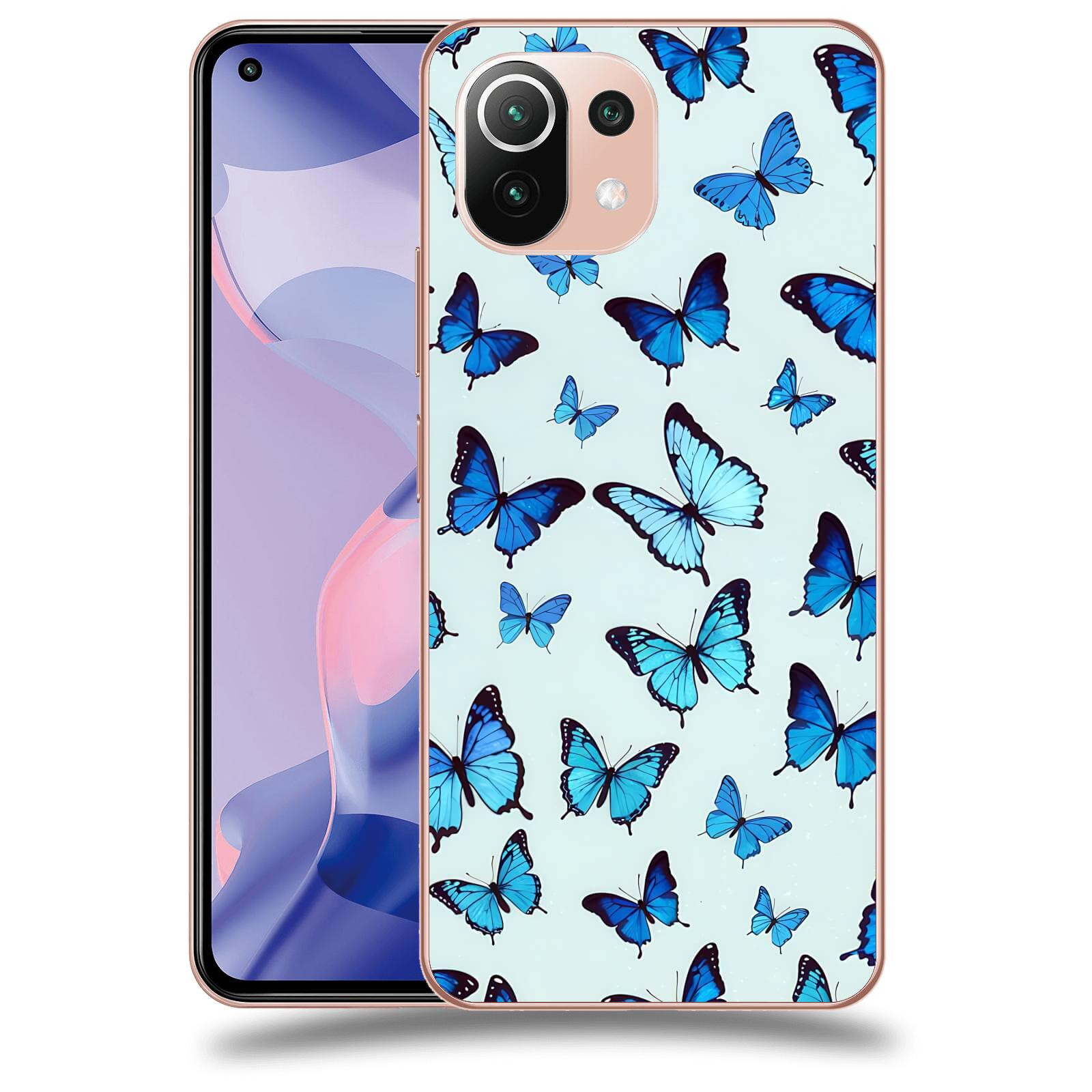 ACOVER Kryt na mobil Xiaomi 11 Lite 5G NE - Svoboda a Lehkos