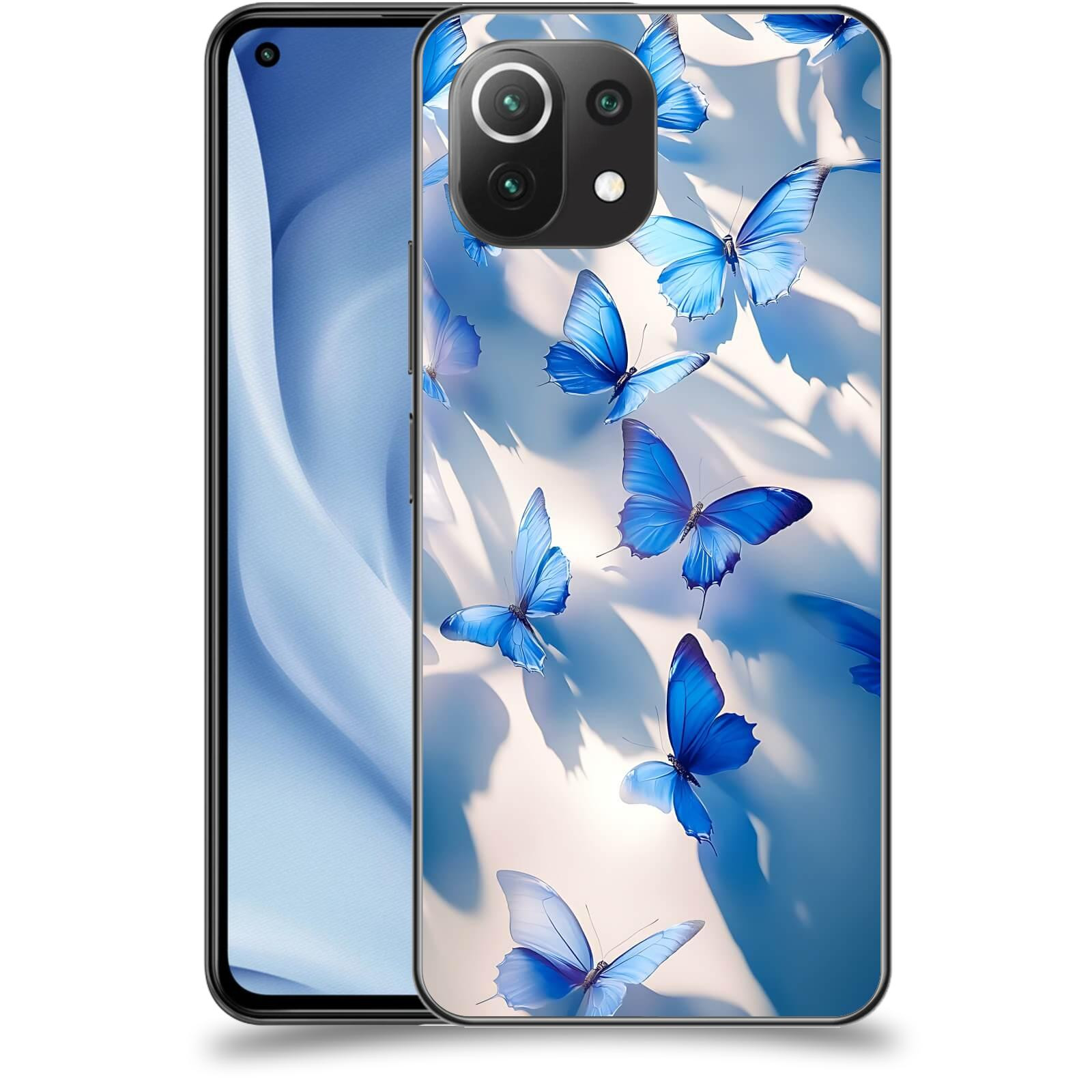 ACOVER Kryt na mobil Xiaomi Mi 11 Lite - Něžnost a Světlo