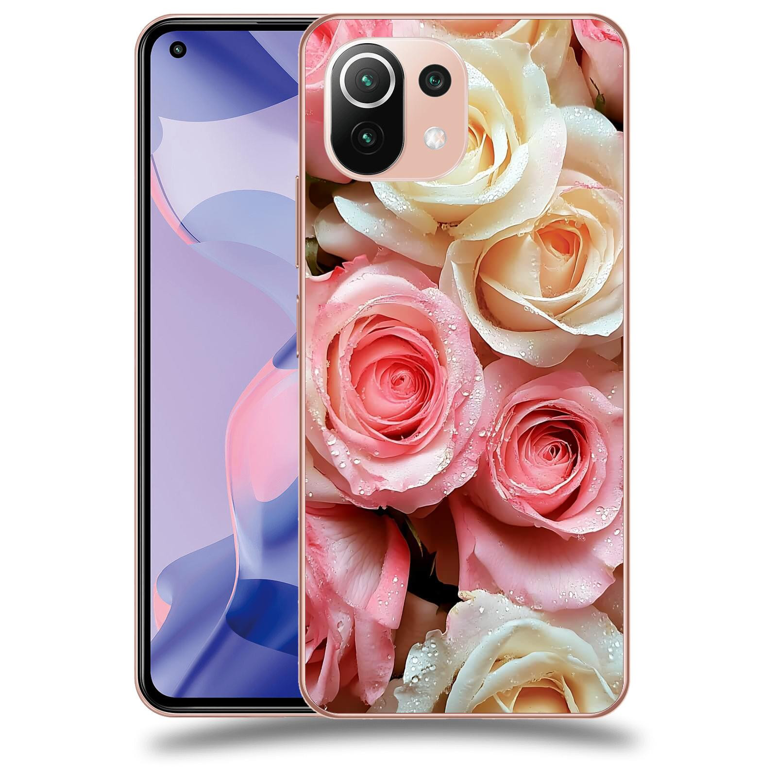 ACOVER Kryt na mobil Xiaomi 11 Lite 5G NE - Jemná vášeň