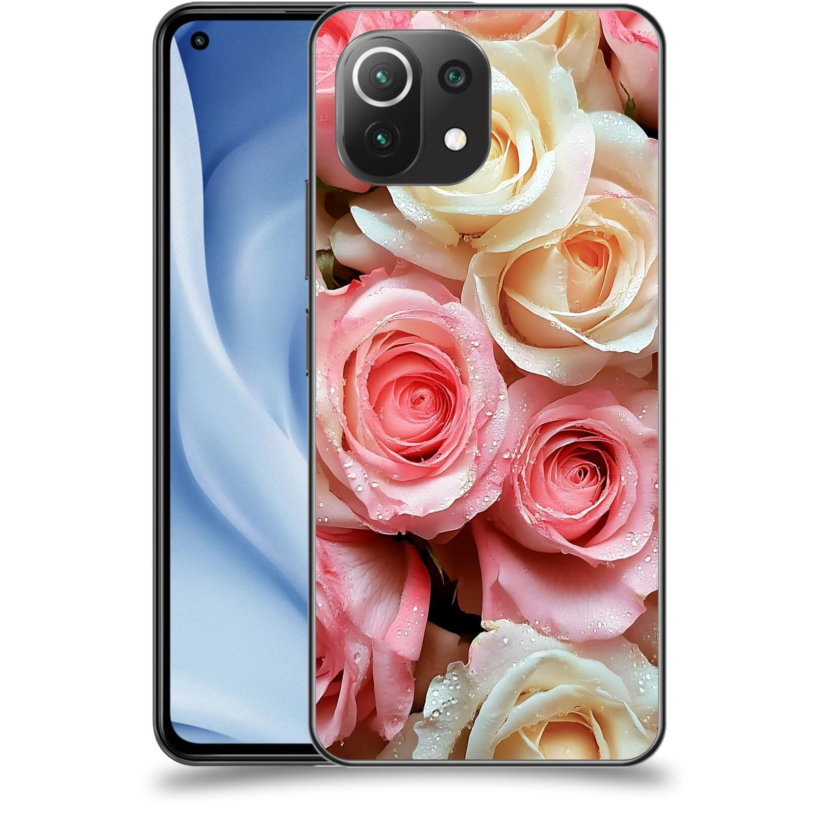 ACOVER Kryt na mobil Xiaomi Mi 11 Lite - Jemná vášeň