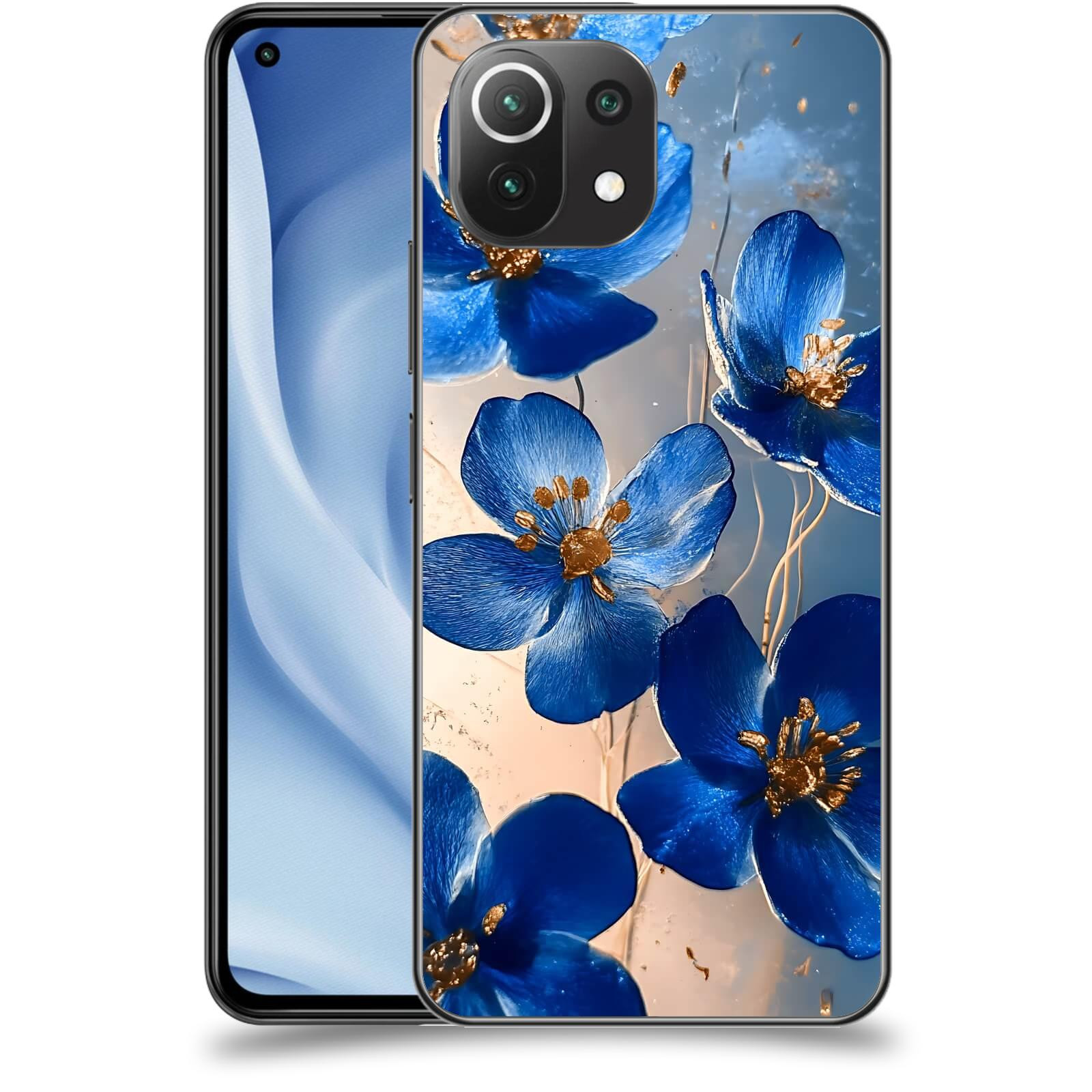ACOVER Kryt na mobil Xiaomi Mi 11 Lite - Zlatá elegance
