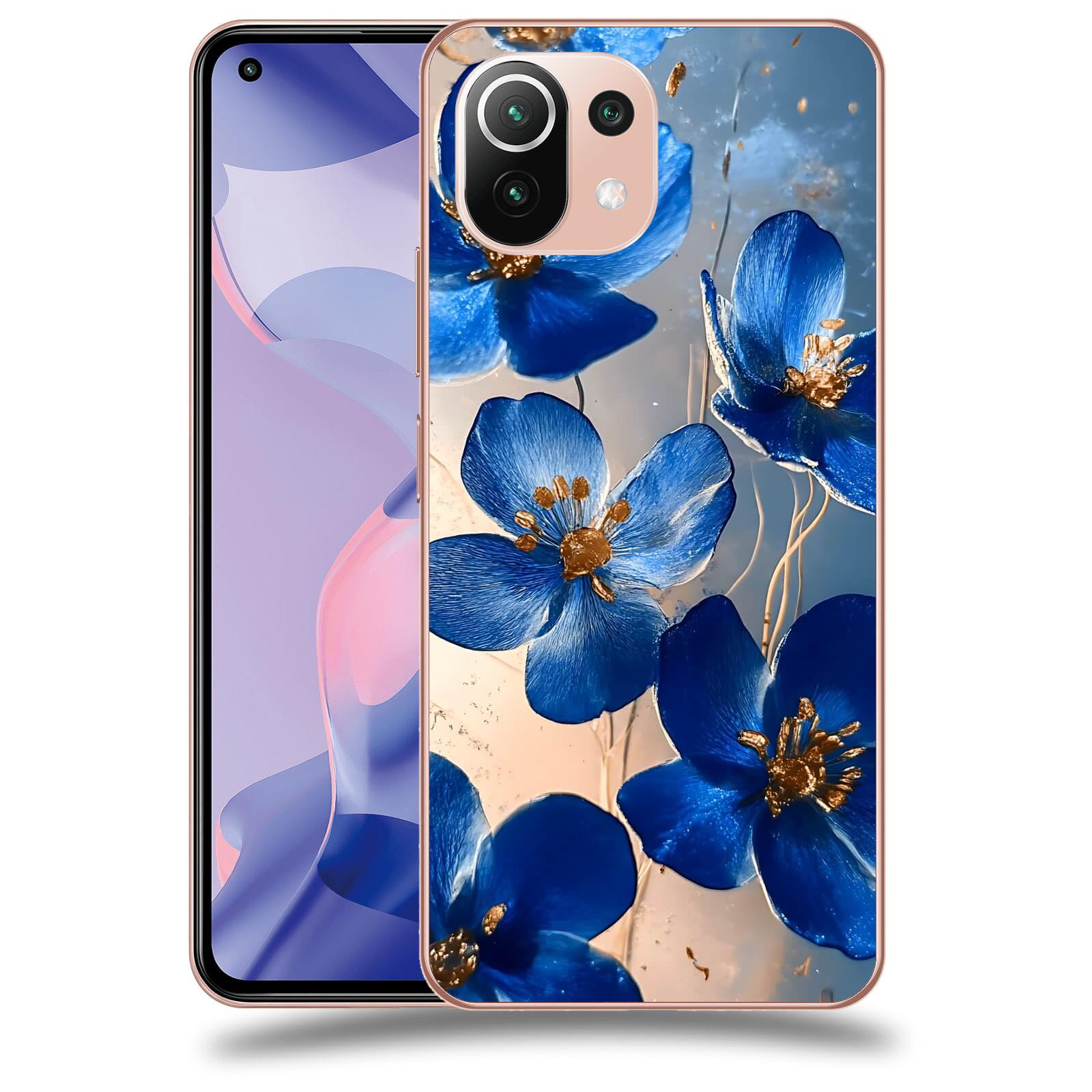 ACOVER Kryt na mobil Xiaomi 11 Lite 5G NE - Zlatá elegance