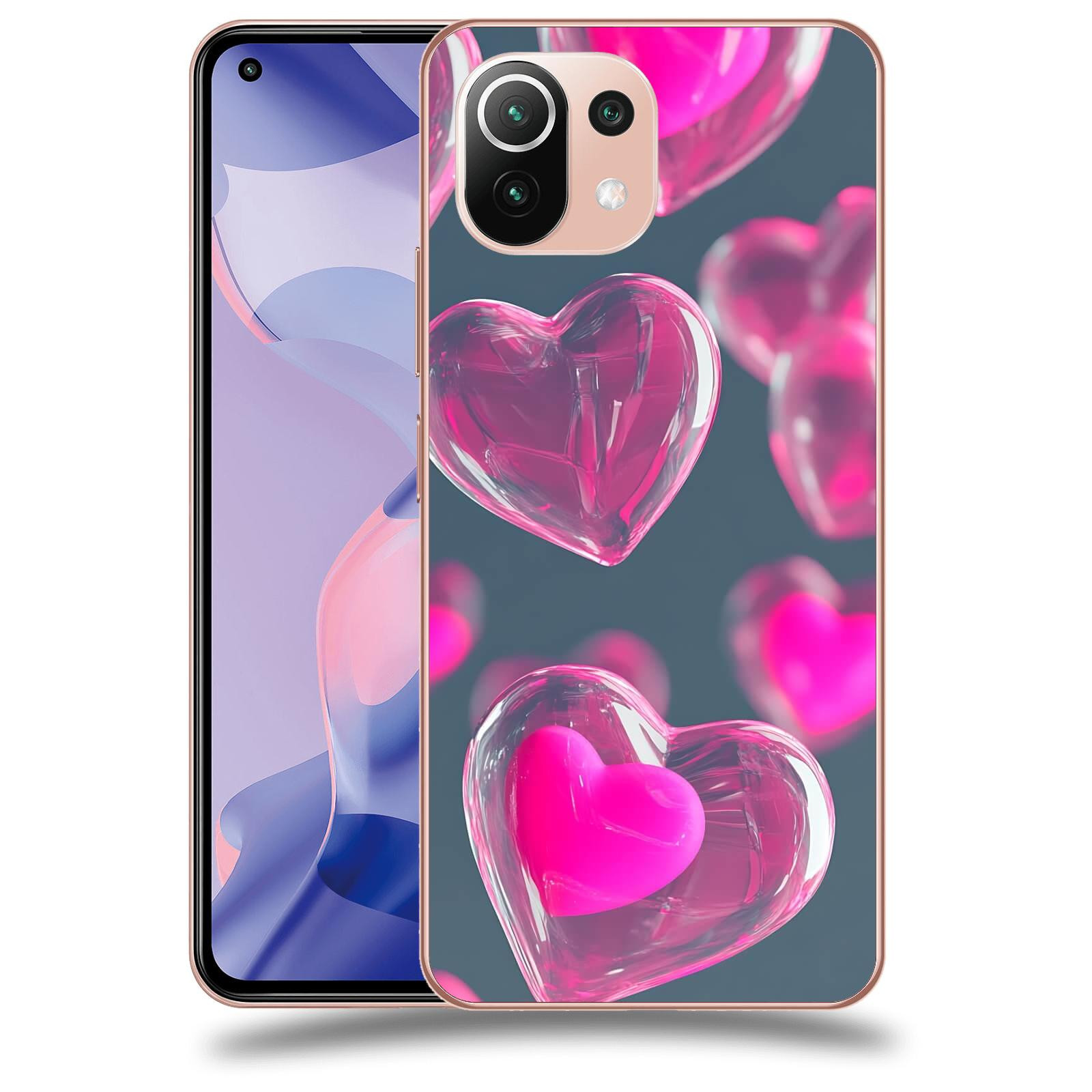 ACOVER Kryt na mobil Xiaomi 11 Lite 5G NE - Láska a Jemnost