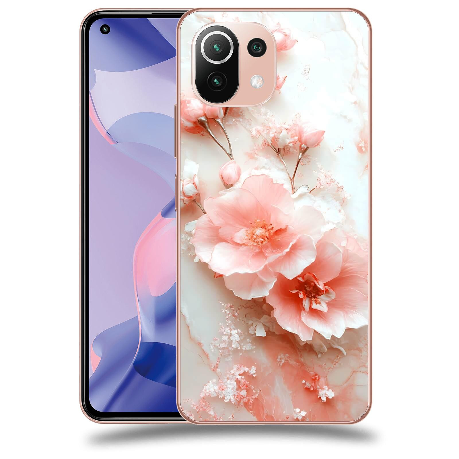 ACOVER Kryt na mobil Xiaomi 11 Lite 5G NE - Jemná elegance