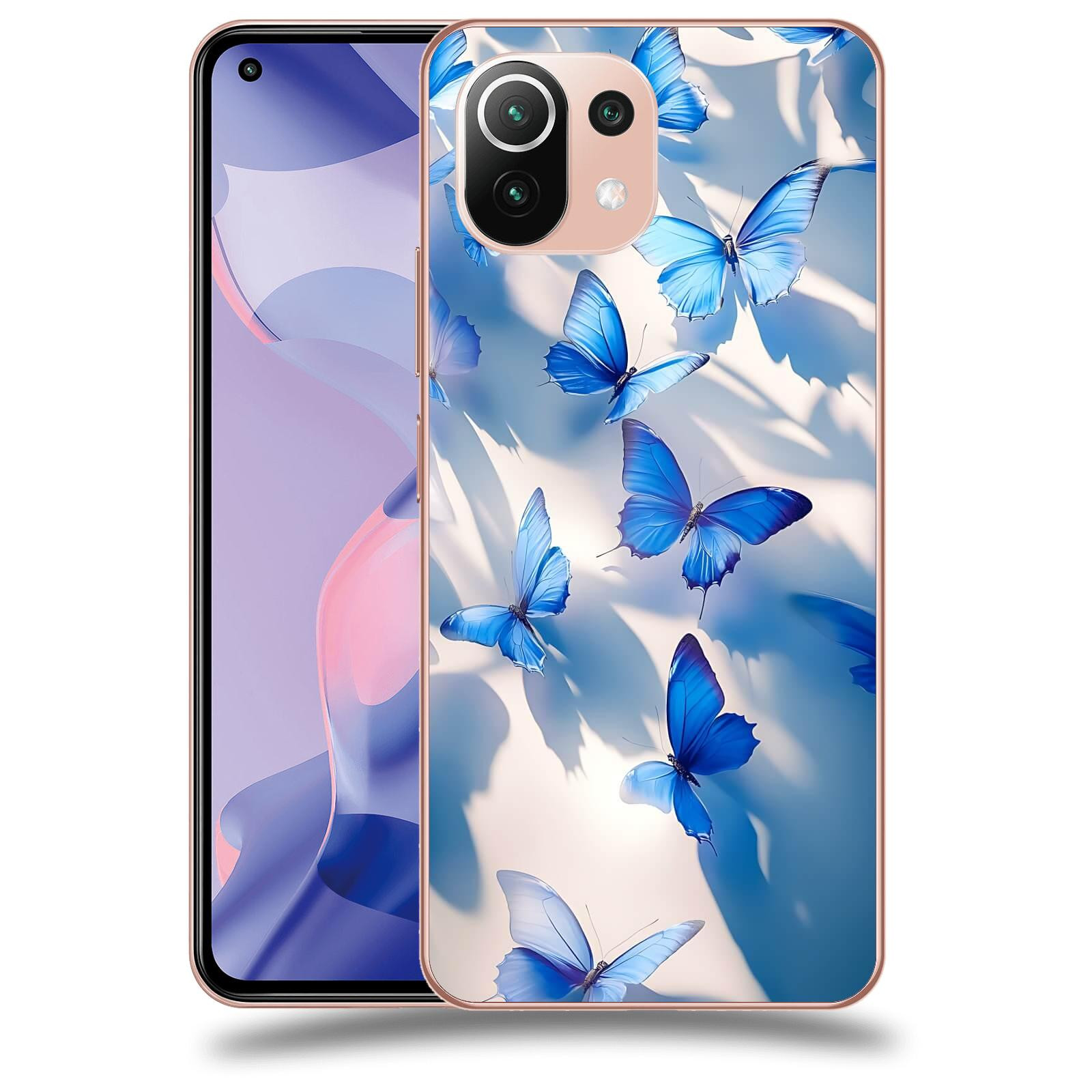 ACOVER Kryt na mobil Xiaomi 11 Lite 5G NE - Něžnost a Světlo