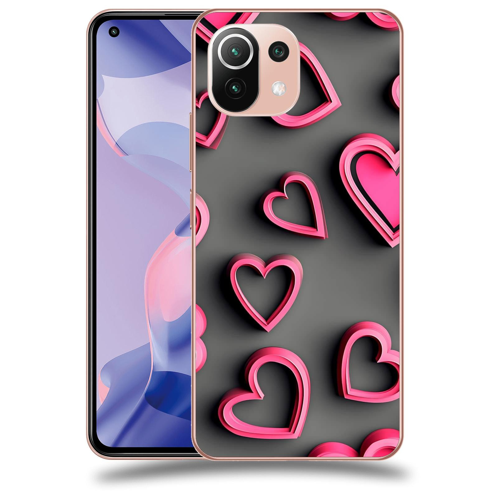 ACOVER Kryt na mobil Xiaomi 11 Lite 5G NE - Romantika a Harmonie
