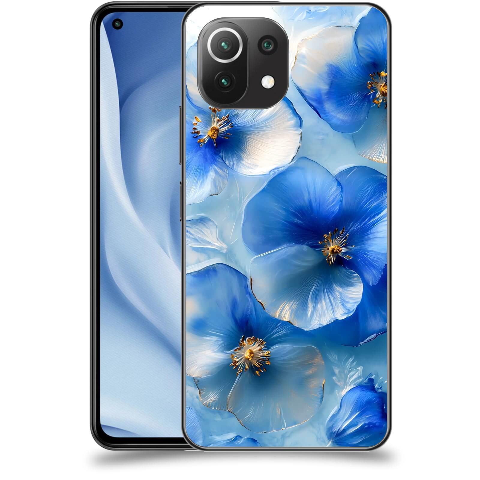 ACOVER Kryt na mobil Xiaomi Mi 11 Lite - Královský klid