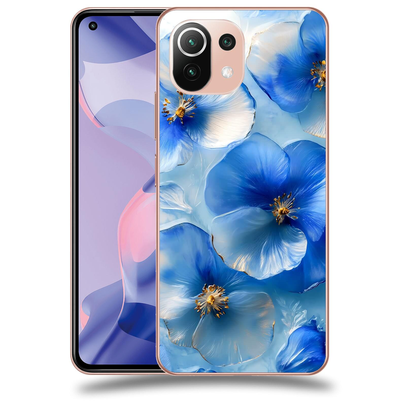ACOVER Kryt na mobil Xiaomi 11 Lite 5G NE - Královský klid