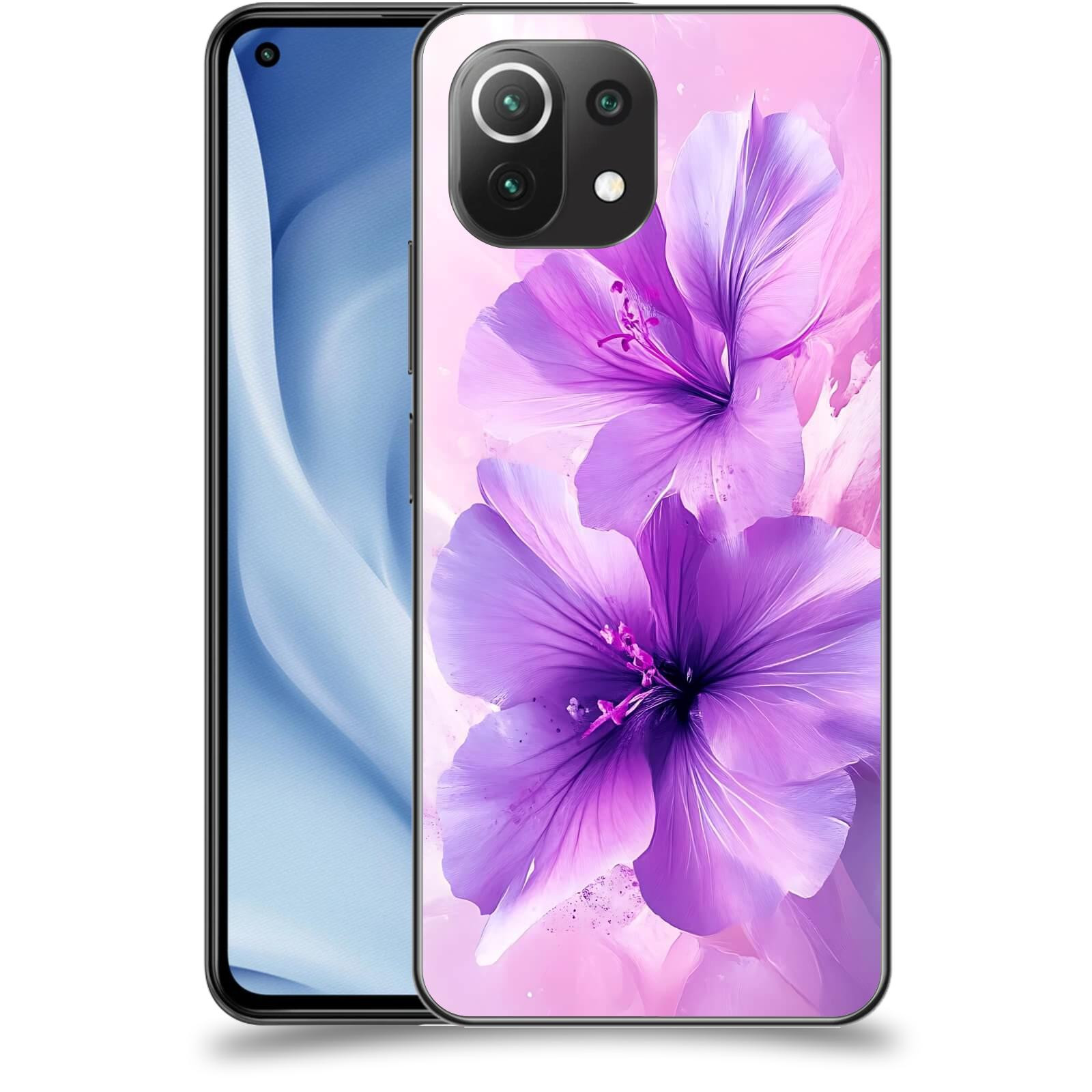 ACOVER Kryt na mobil Xiaomi Mi 11 Lite - Něžná elegance