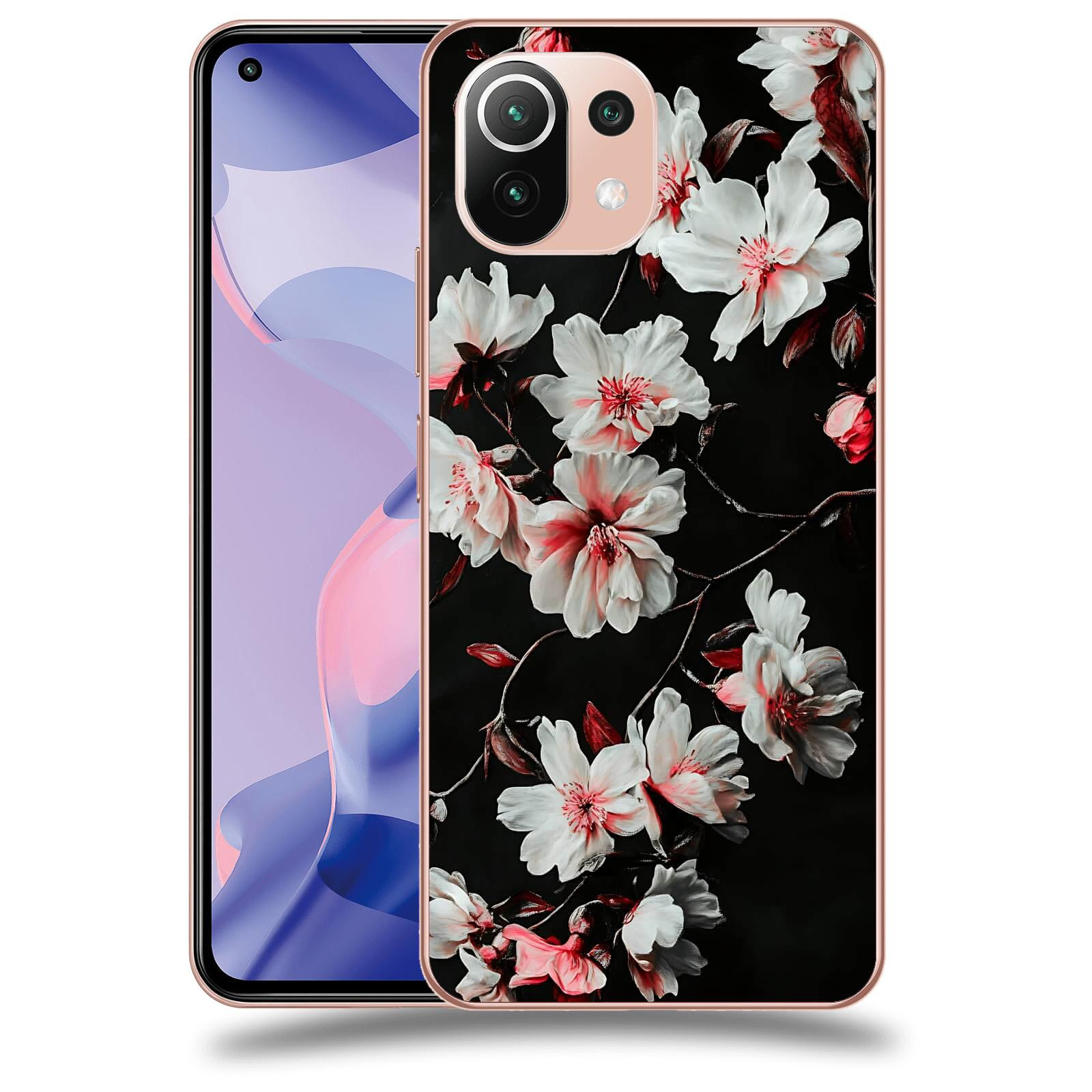 ACOVER Kryt na mobil Xiaomi 11 Lite 5G NE - Temná něžnost