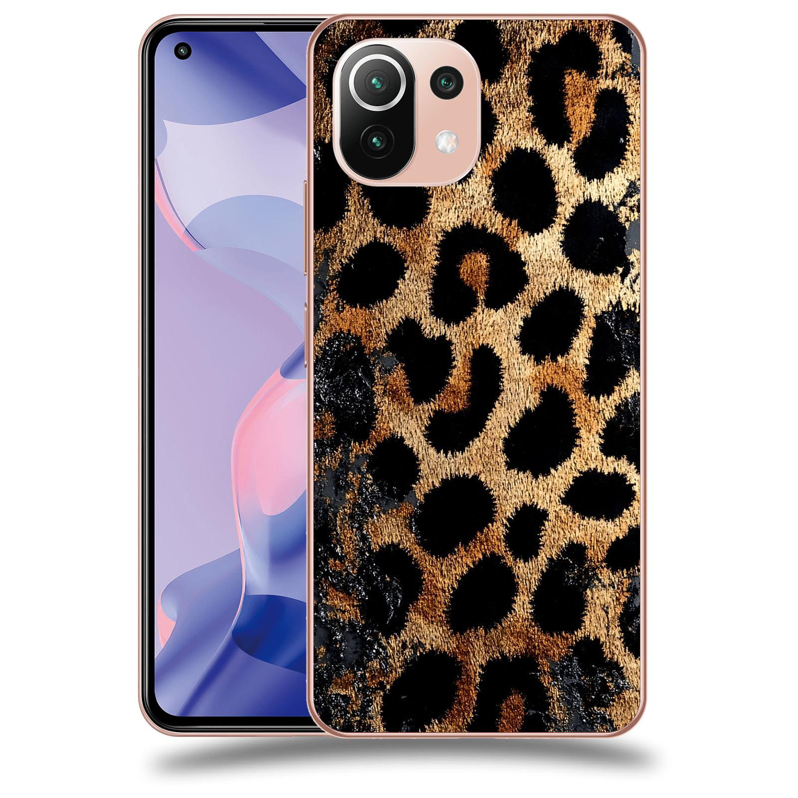 ACOVER Kryt na mobil Xiaomi 11 Lite 5G NE - Dravost a Luxus