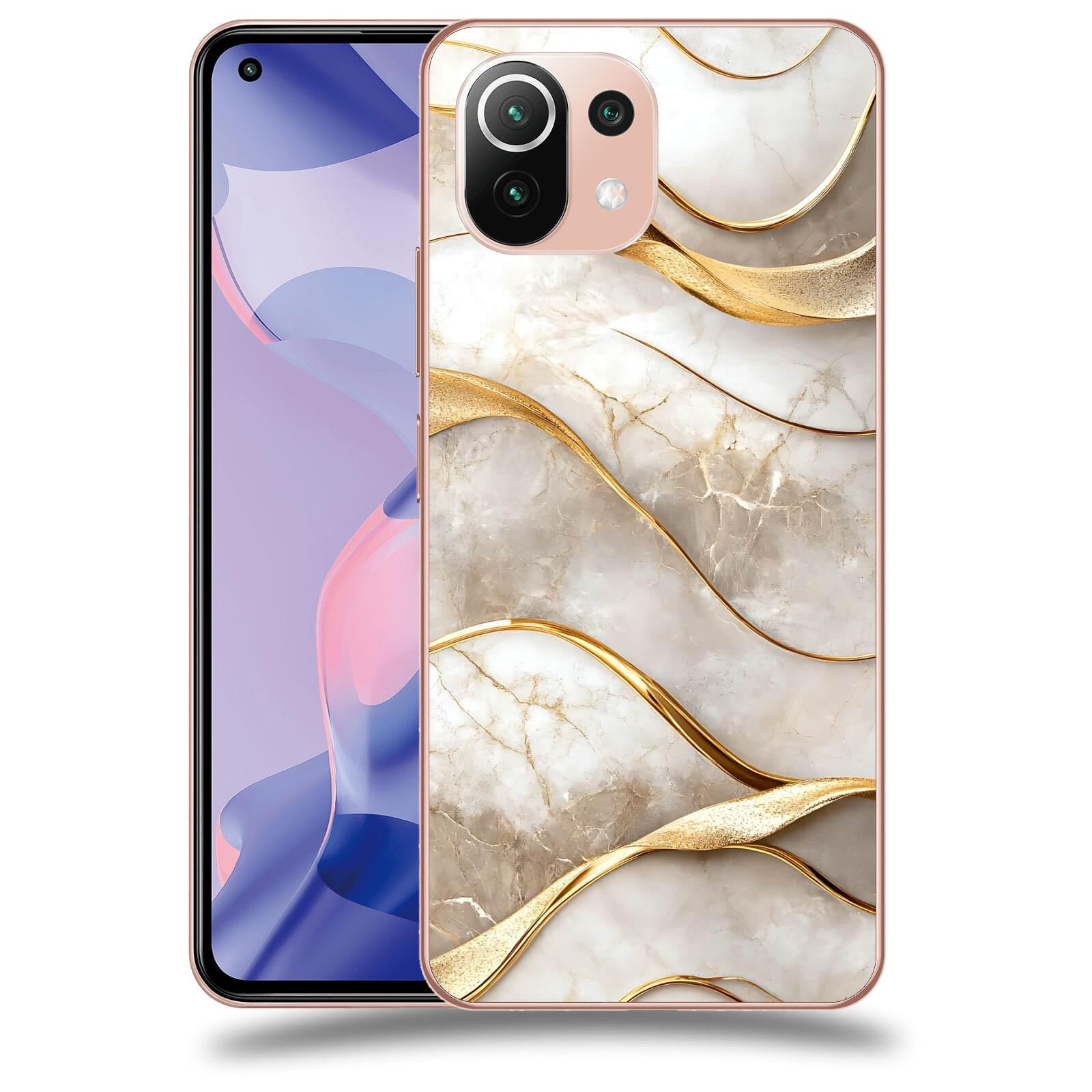 ACOVER Kryt na mobil Xiaomi 11 Lite 5G NE - Elegantní plynutí