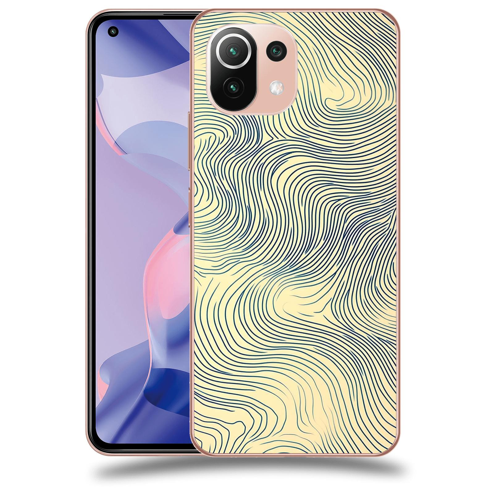 ACOVER Kryt na mobil Xiaomi 11 Lite 5G NE - Dynamická textura