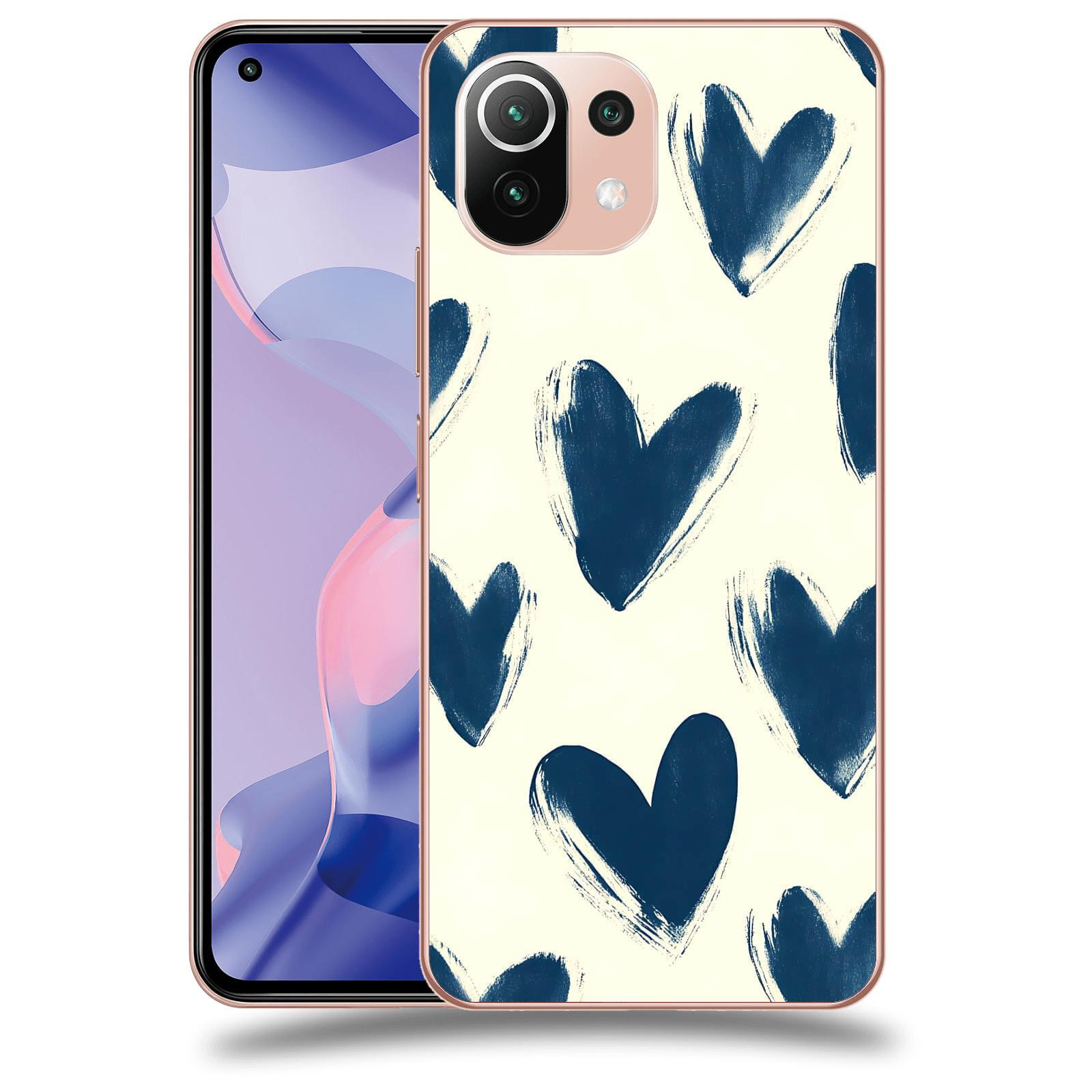 ACOVER Kryt na mobil Xiaomi 11 Lite 5G NE - Blue hearts