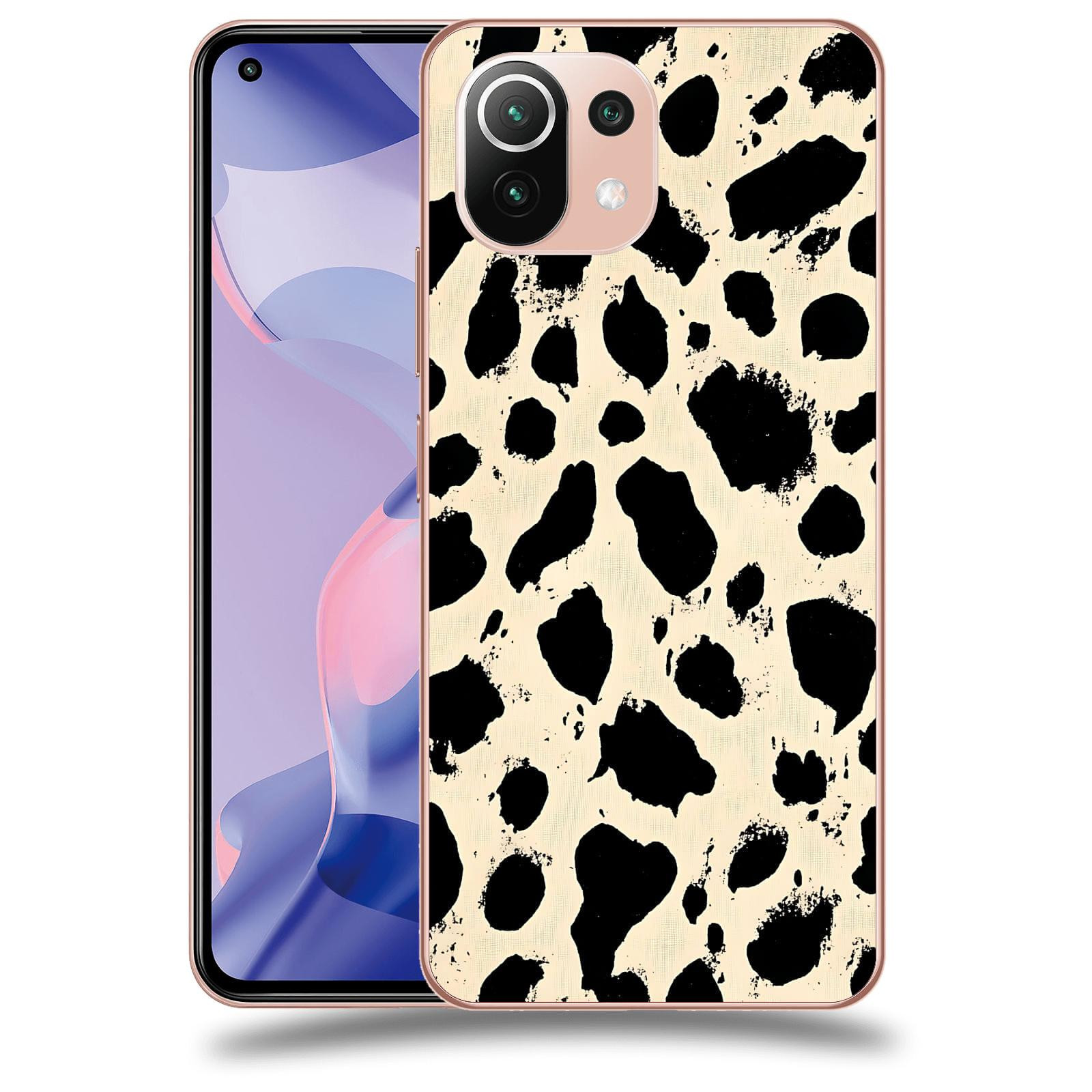 ACOVER Kryt na mobil Xiaomi 11 Lite 5G NE - Black dots