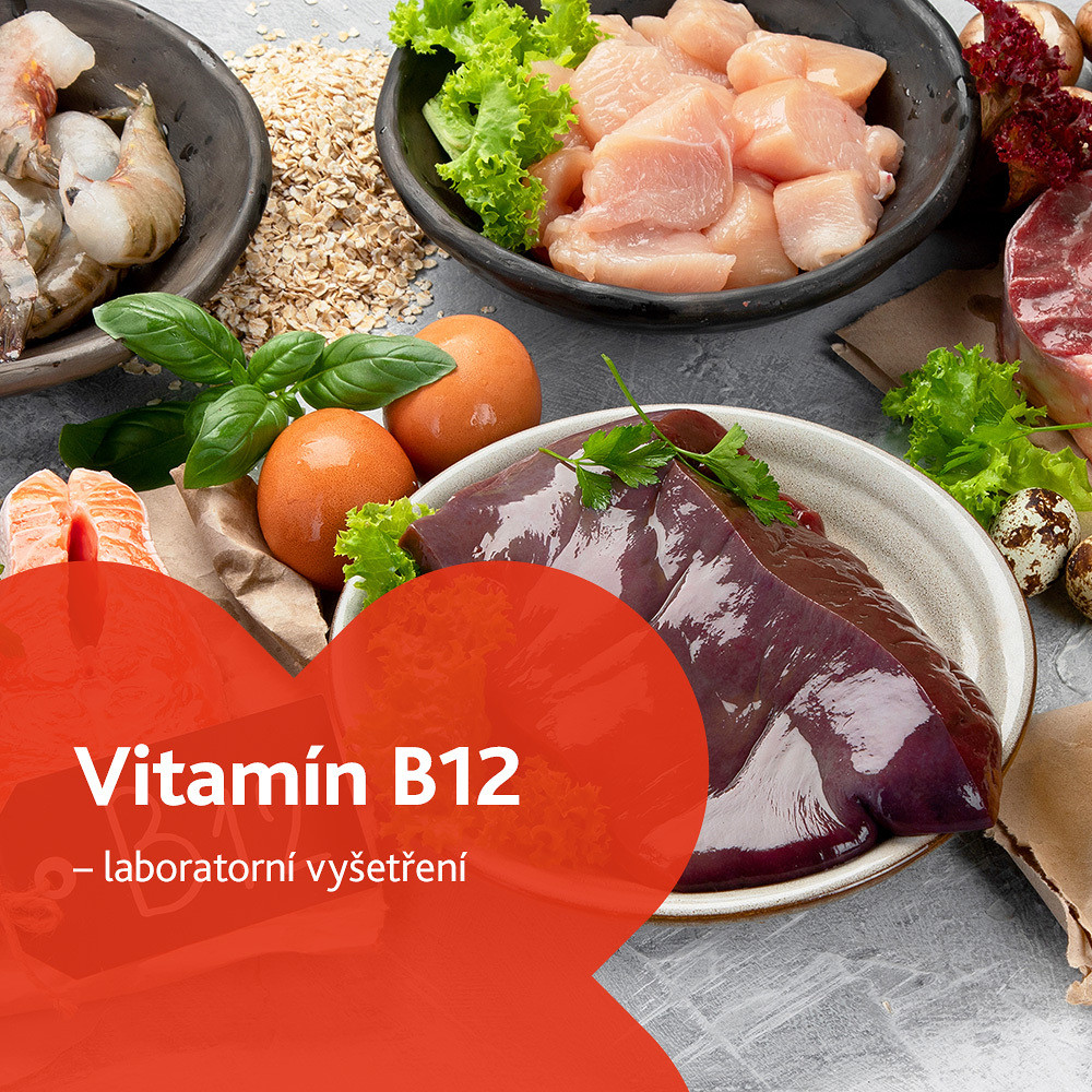 Vitamín B12 - laboratorní vyšetření