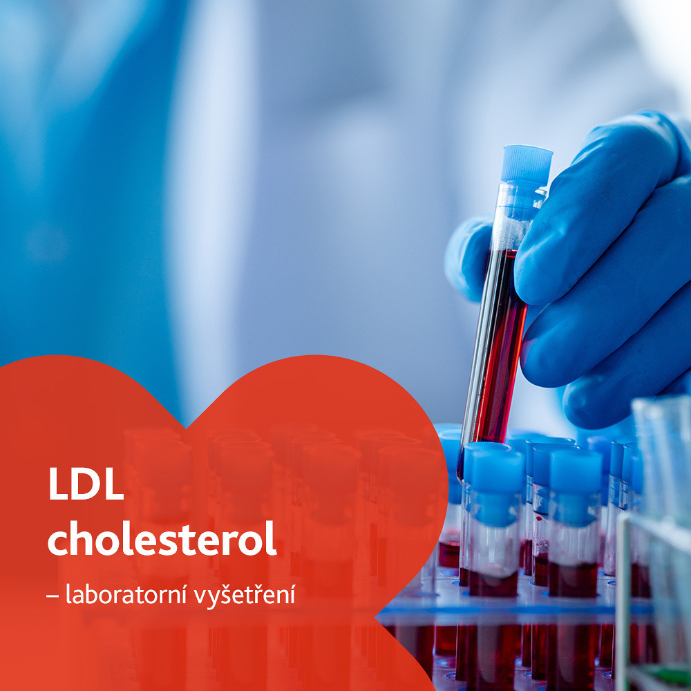 LDL cholesterol - laboratorní vyšetření