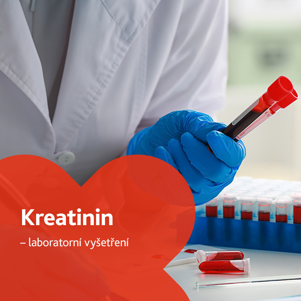 Kreatinin - laboratorní vyšetření