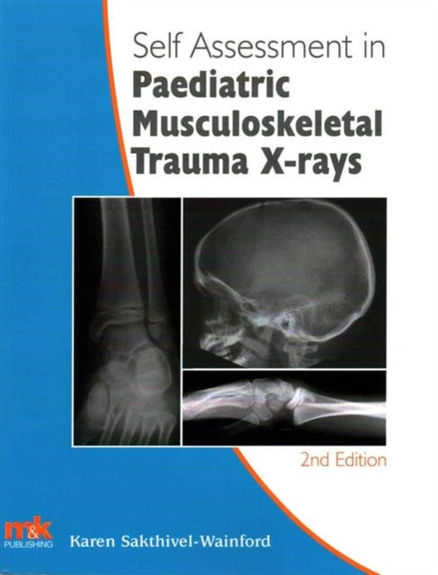 Self-Assessment in Paediatric Musculoskeletal Trauma X-Rays - (Sakthivel-Wainford Karen)(Paperback / softback)