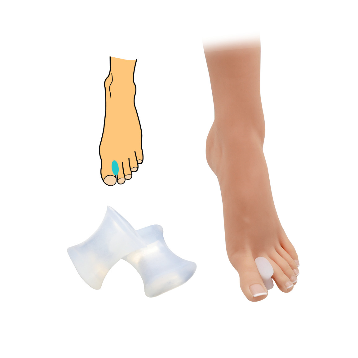 Hallux valgus korektor HealMed 2 ks - průhledný, velká