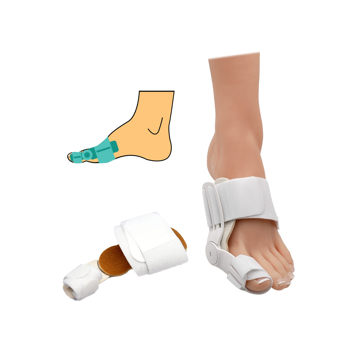 Denní bandáž HealMed Hallux valgus 1 ks - bílý