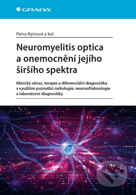Neuromyelitis optica a poruchy jejího širšího spektra - Nytrová Petra a kolektiv
